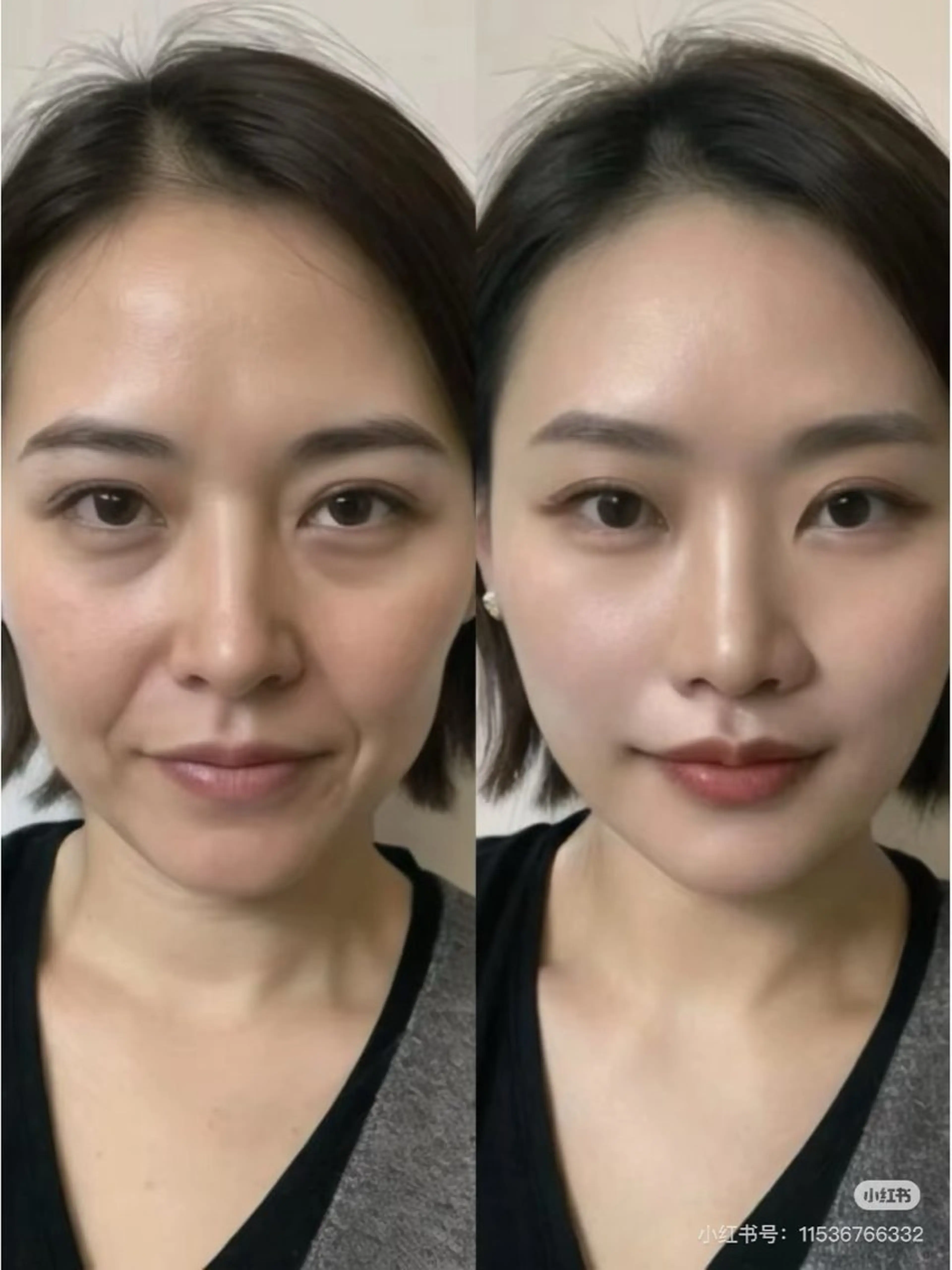 ネイル エステ aliaハイフ&水光ジェットサロン所属・aliaハーブ水光店 エステティシャン募集のエステ・リラクイメージ