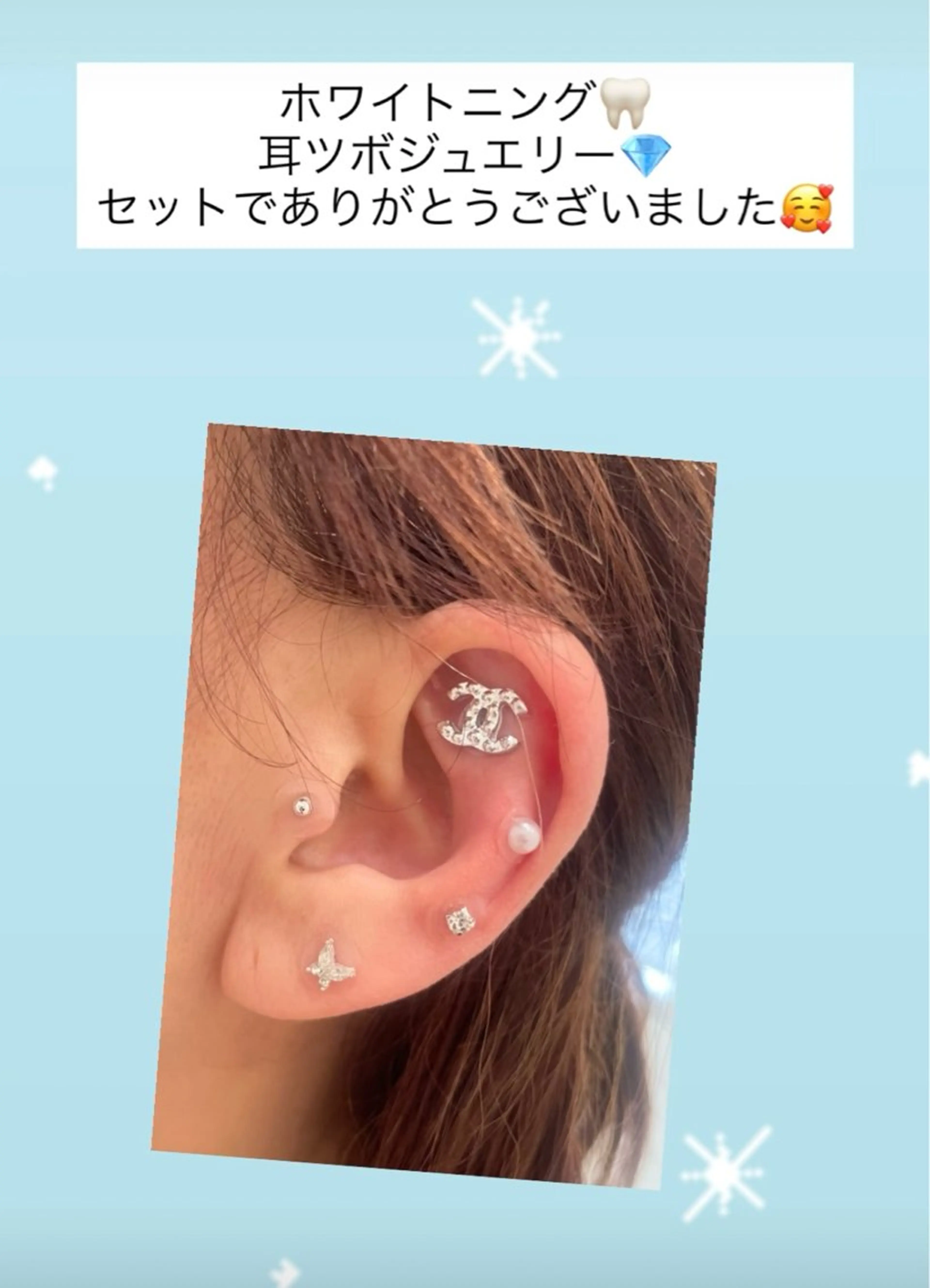 Kaula所属・Kaula ホワイトニング耳ツボのその他イメージ