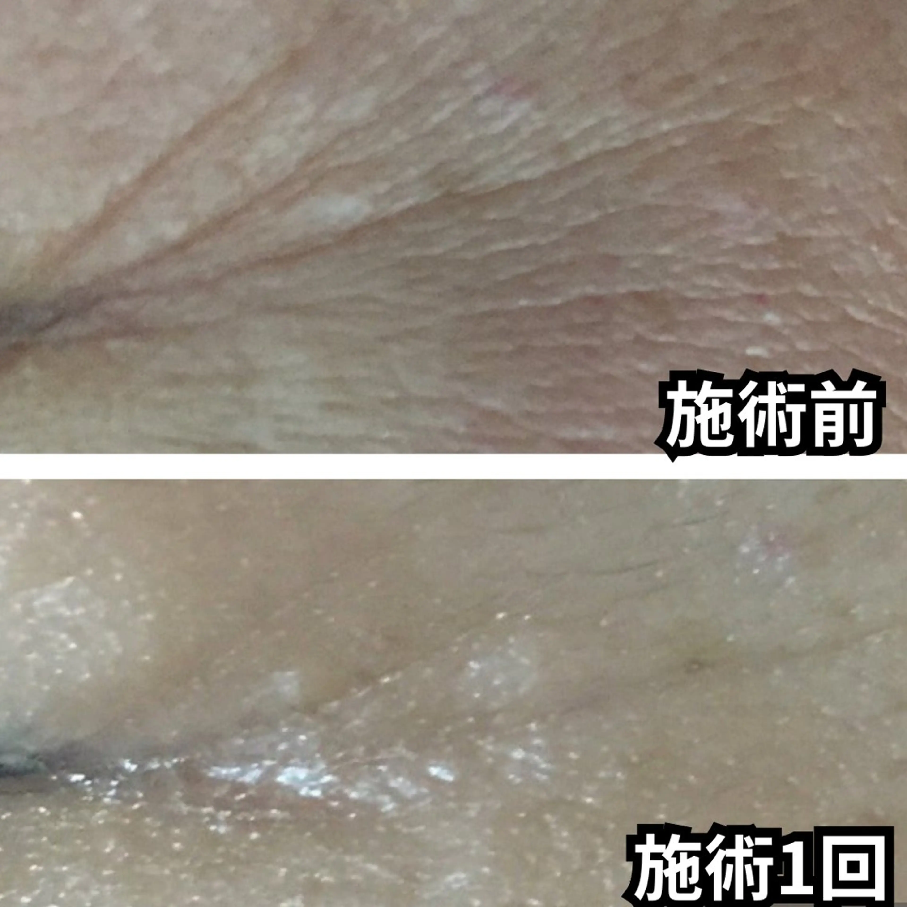 【しわ集中改善】たるみ・乾燥小じわを徹底ケア！の写真