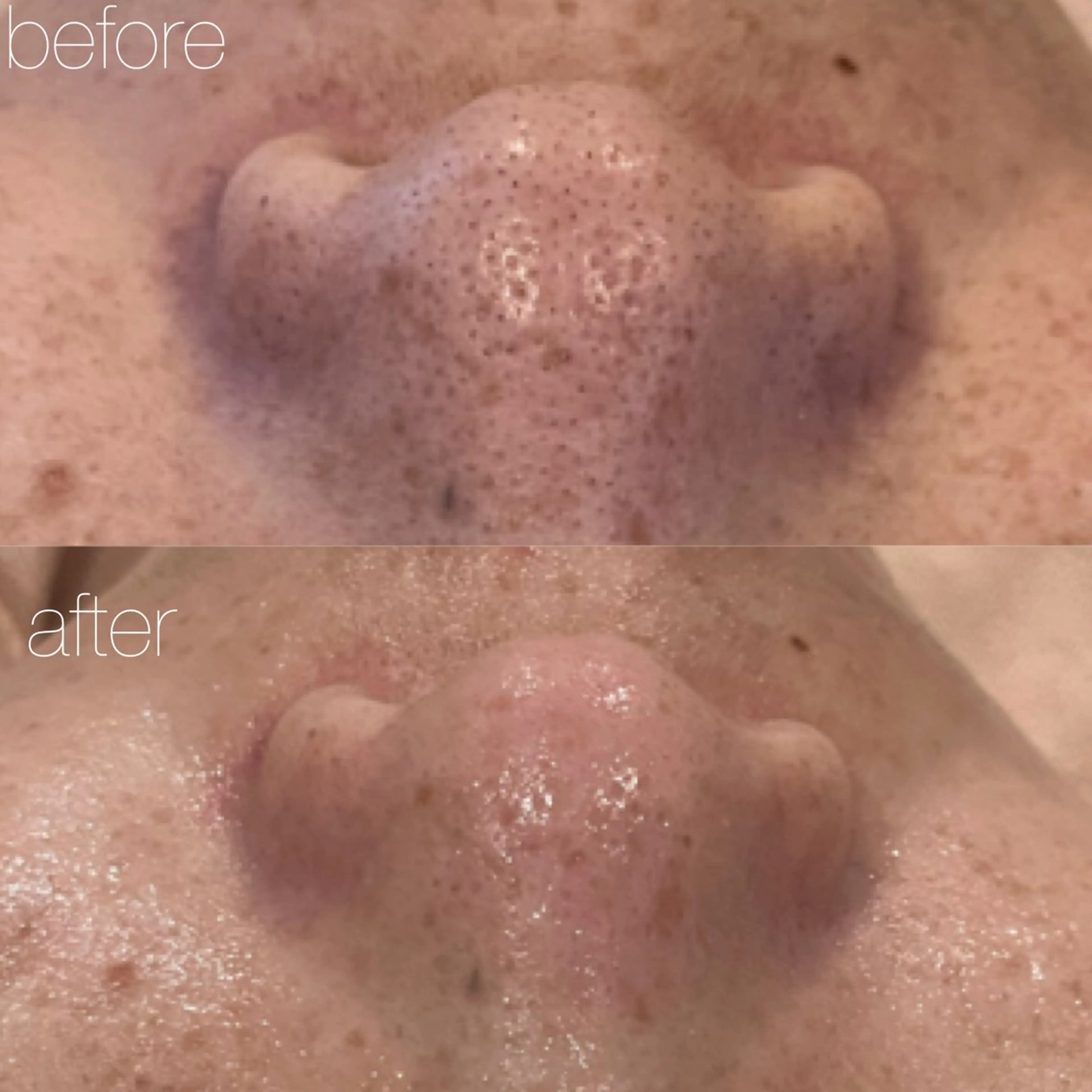 【しみ毛穴専門店】beautysalon Ankh所属・しみ毛穴専門店 Ankh 平田のエステ・リラクイメージ