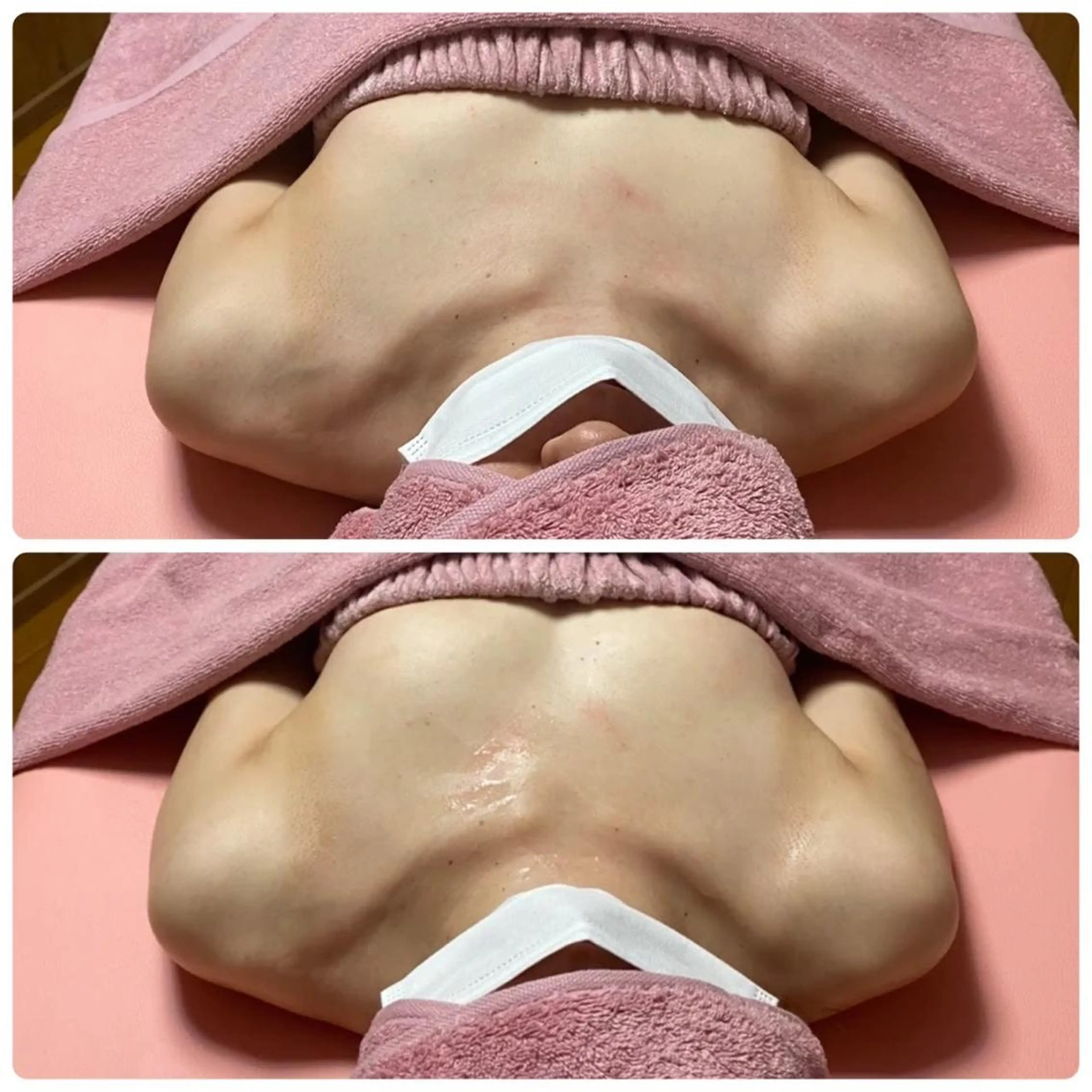 ミラクルバストプレミアムの写真