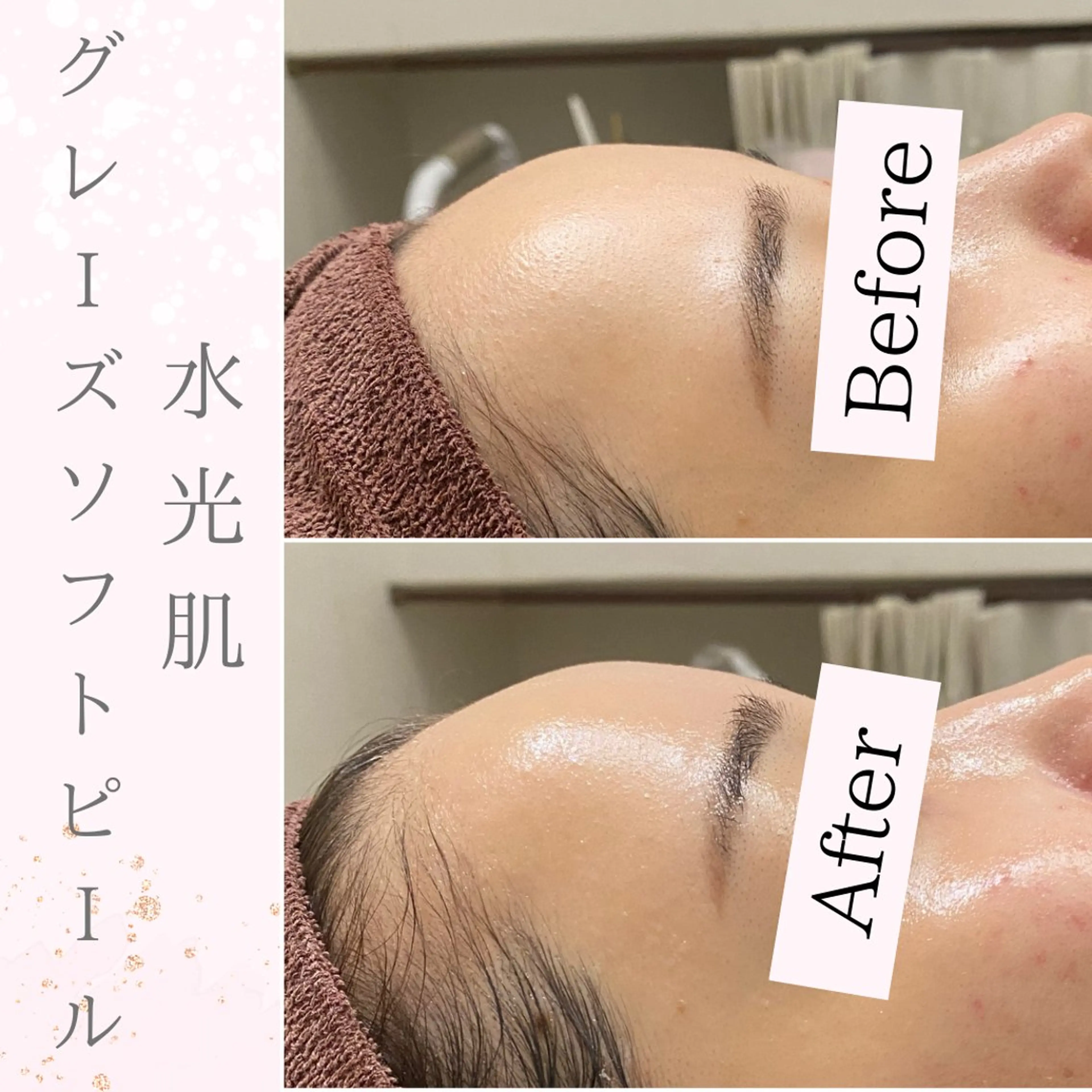 Purua beuty所属・月1肌管理 RINAのエステ・リラクイメージ