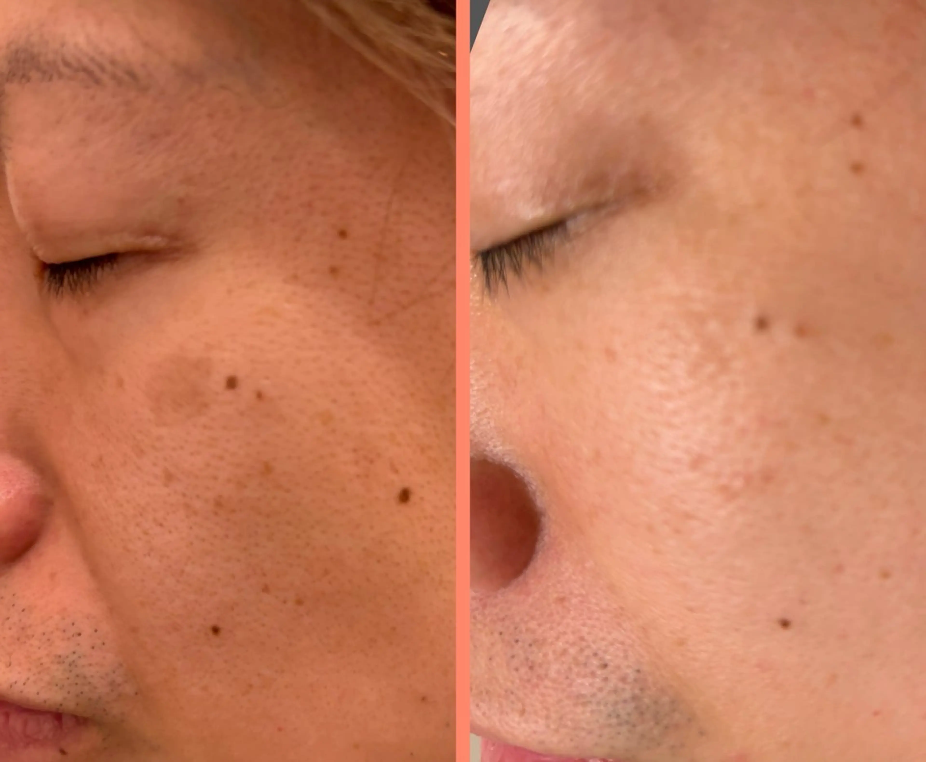 大阪大東市 / 体質・肌質改善サロン アンシャンテ所属・体質・肌質改善サロン アンシャンテのエステ・リラクイメージ