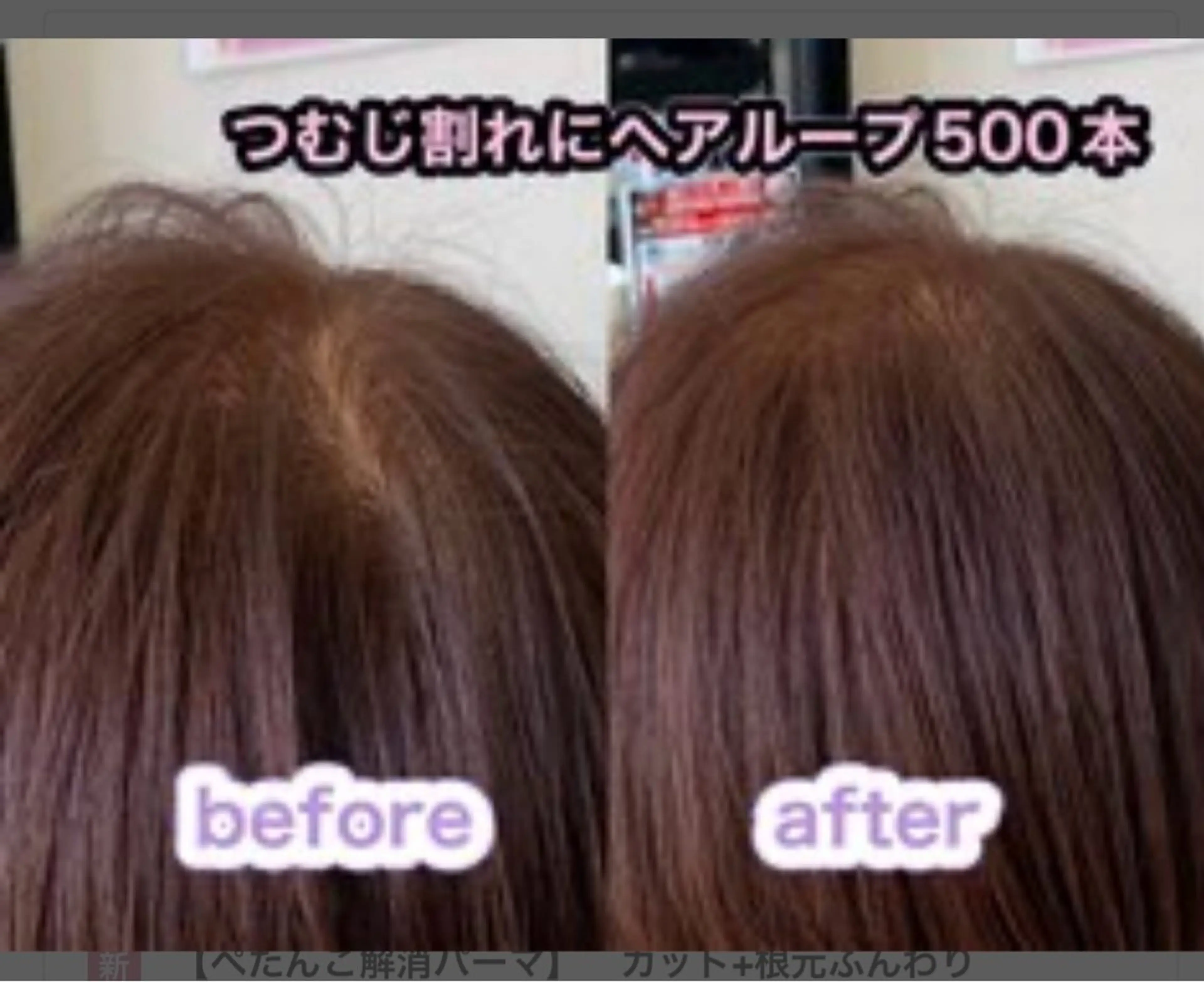 つむじの割れを解消エクステ。ヘアループ。ボリュームアップエクステ500本の写真