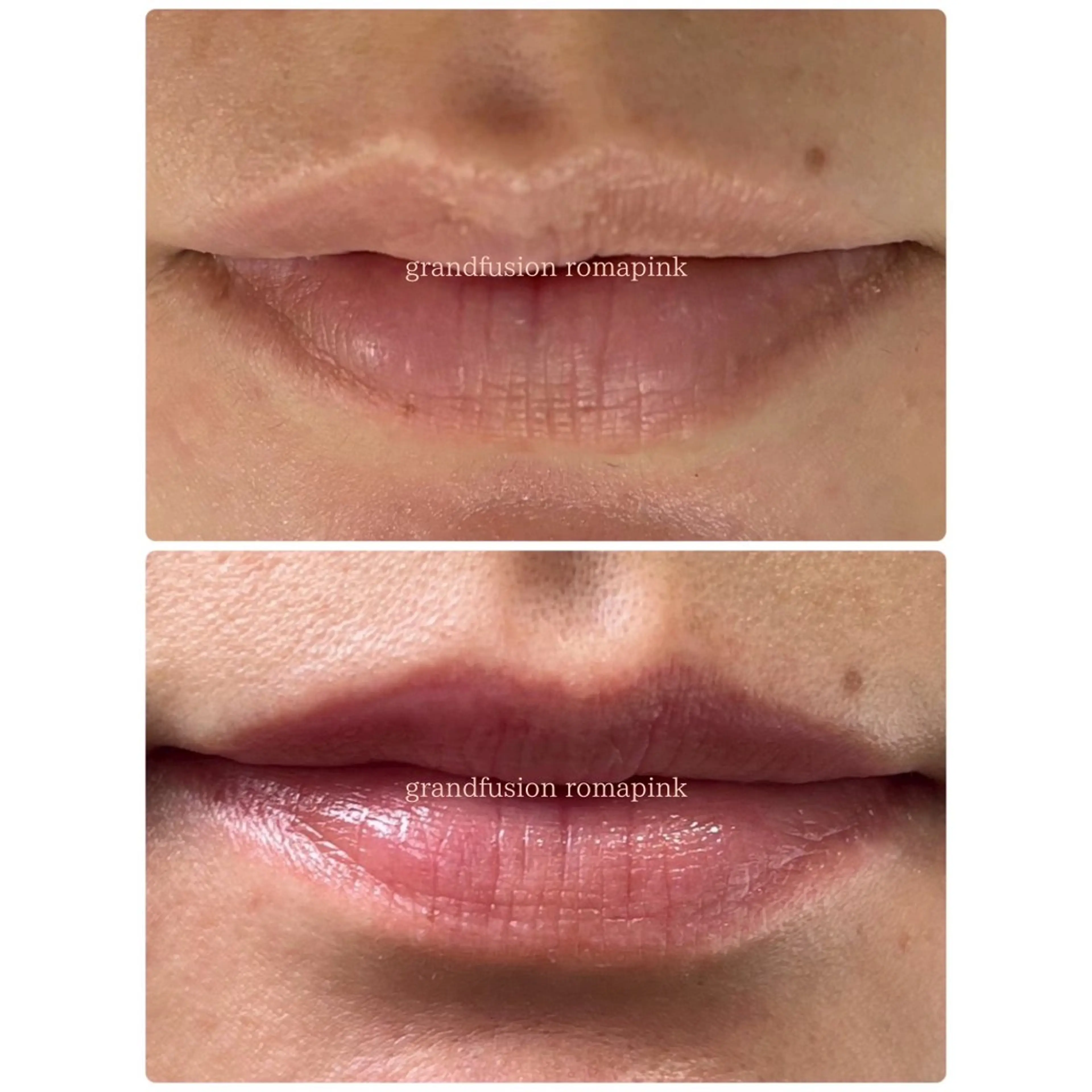 エステ Richeri 代官山のエステ・リラクイメージ