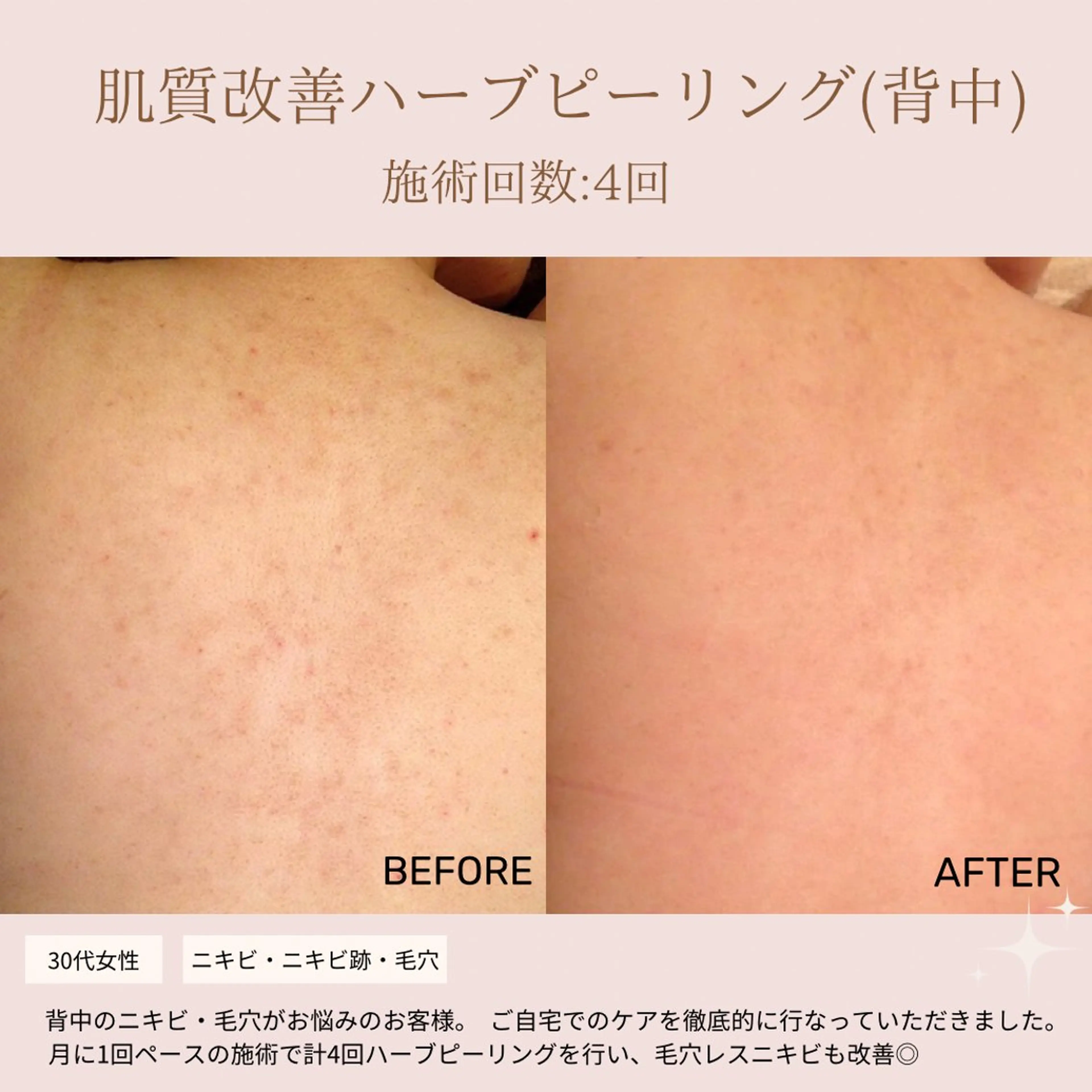 肌質改善専門サロン Bellmi/心斎橋のエステ・リラクイメージ