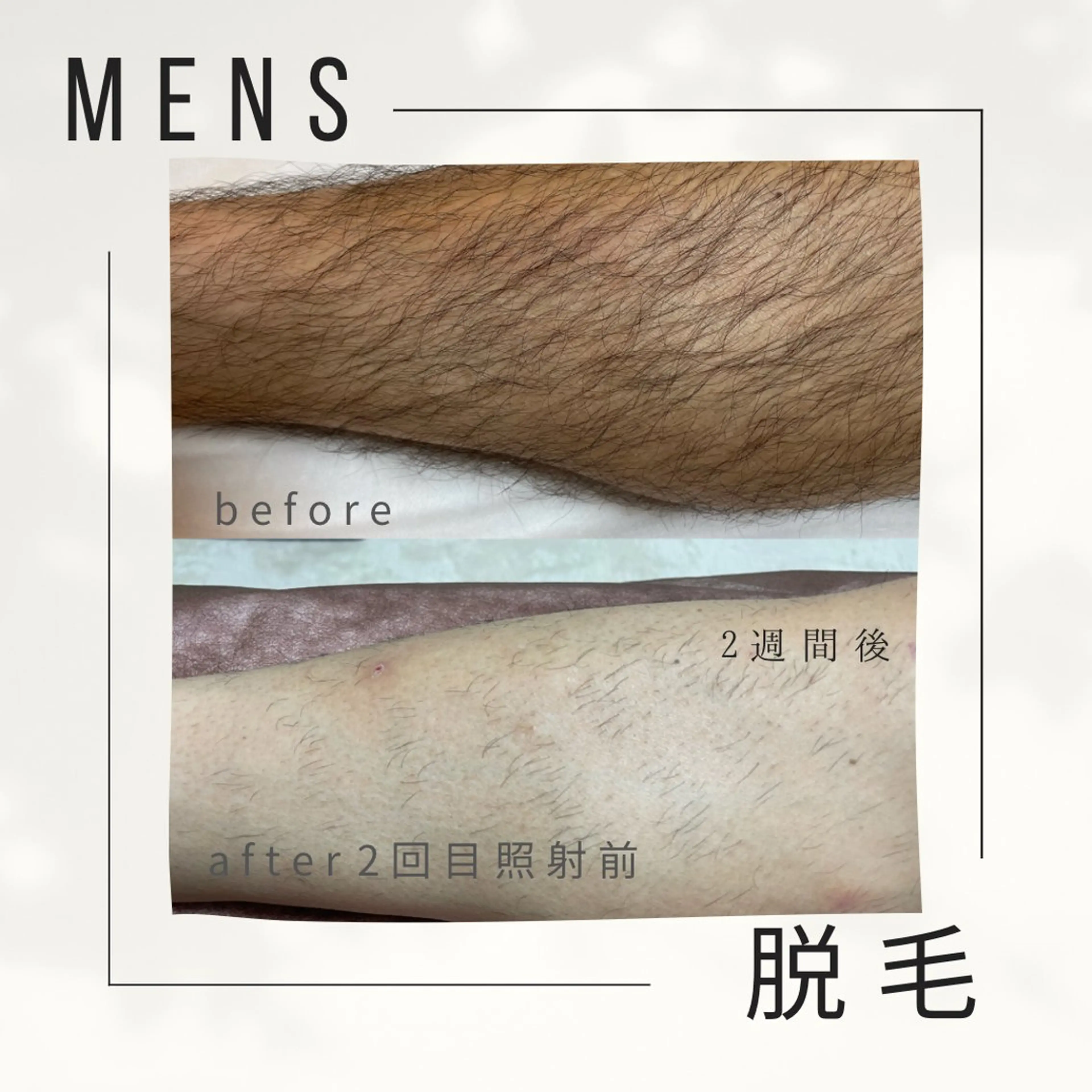 メンズ private salon    olu olu所属・生井 美枝のエステ・リラクイメージ