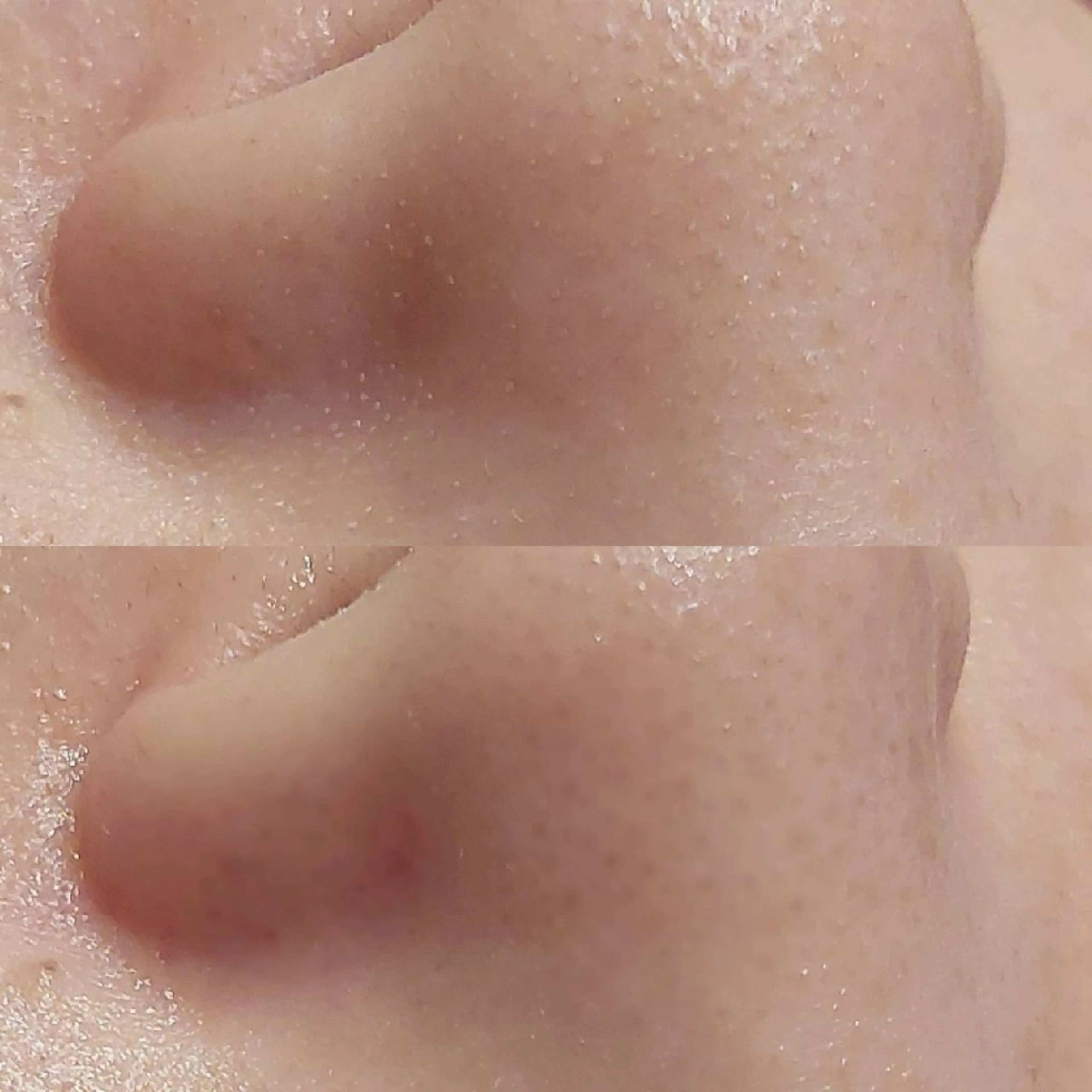 エステ MyFairLady miuのエステ・リラクイメージ