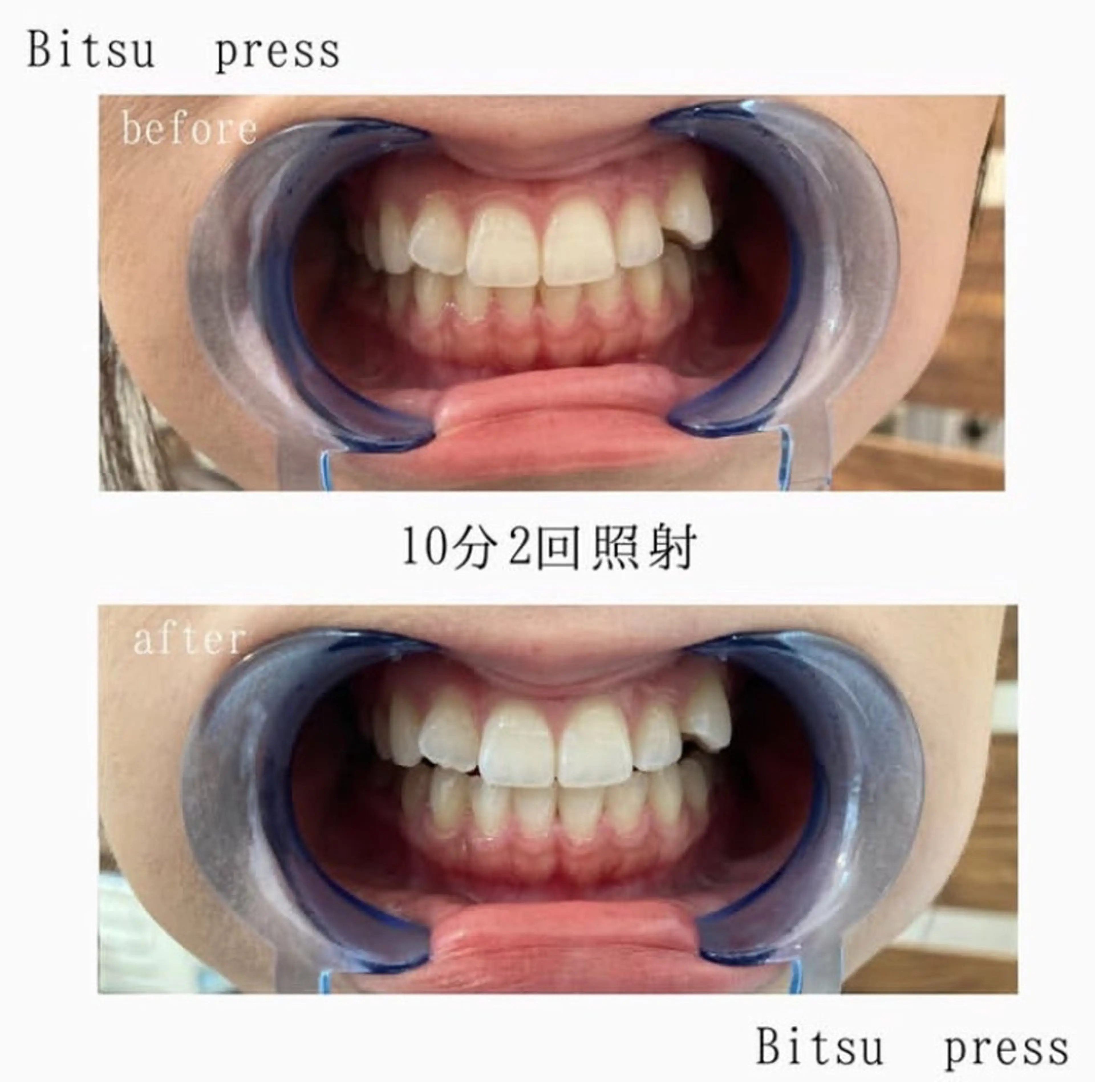 PRESS 高野🥀のエステ・リラクイメージ