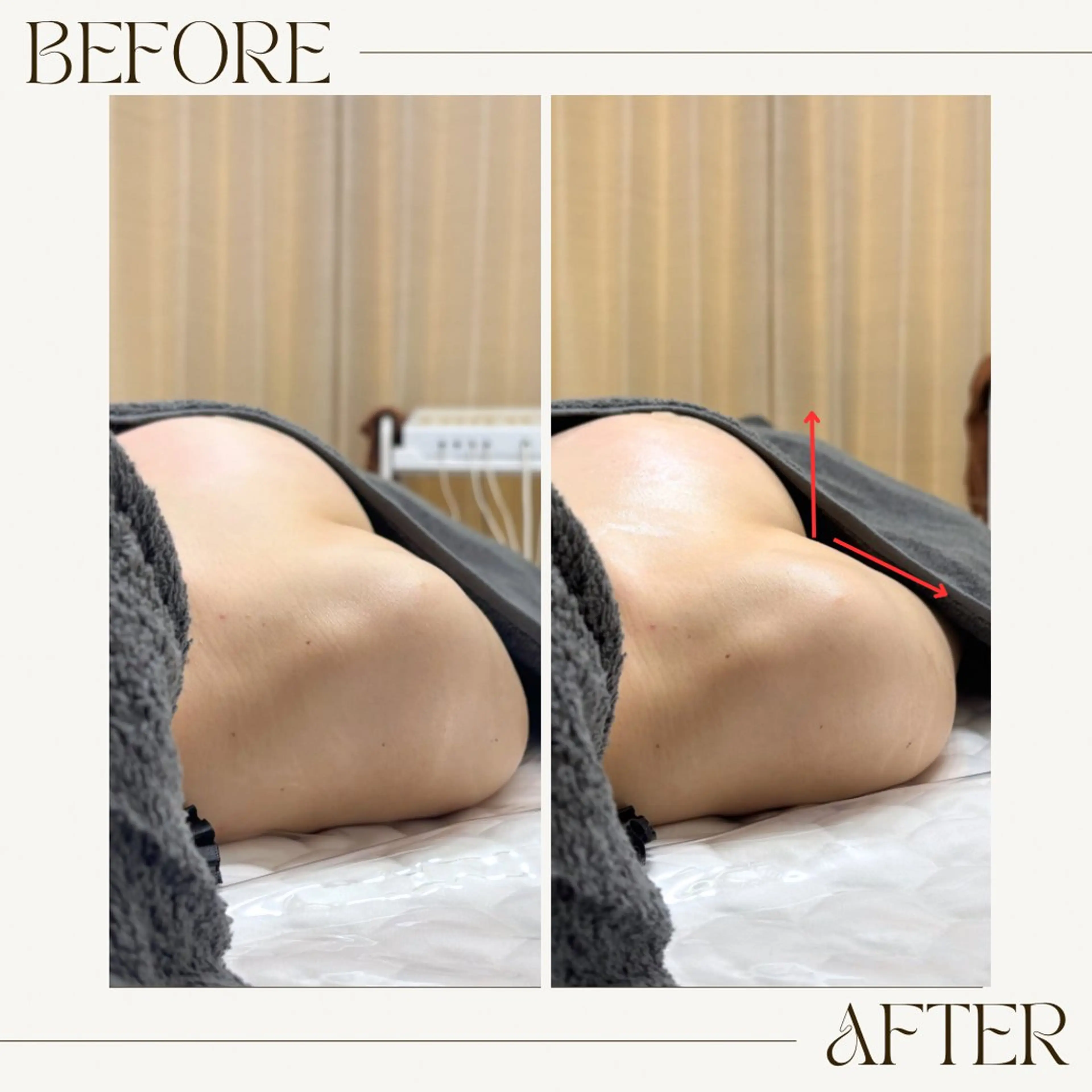 バストケア専門店| canyのエステ・リラクイメージ