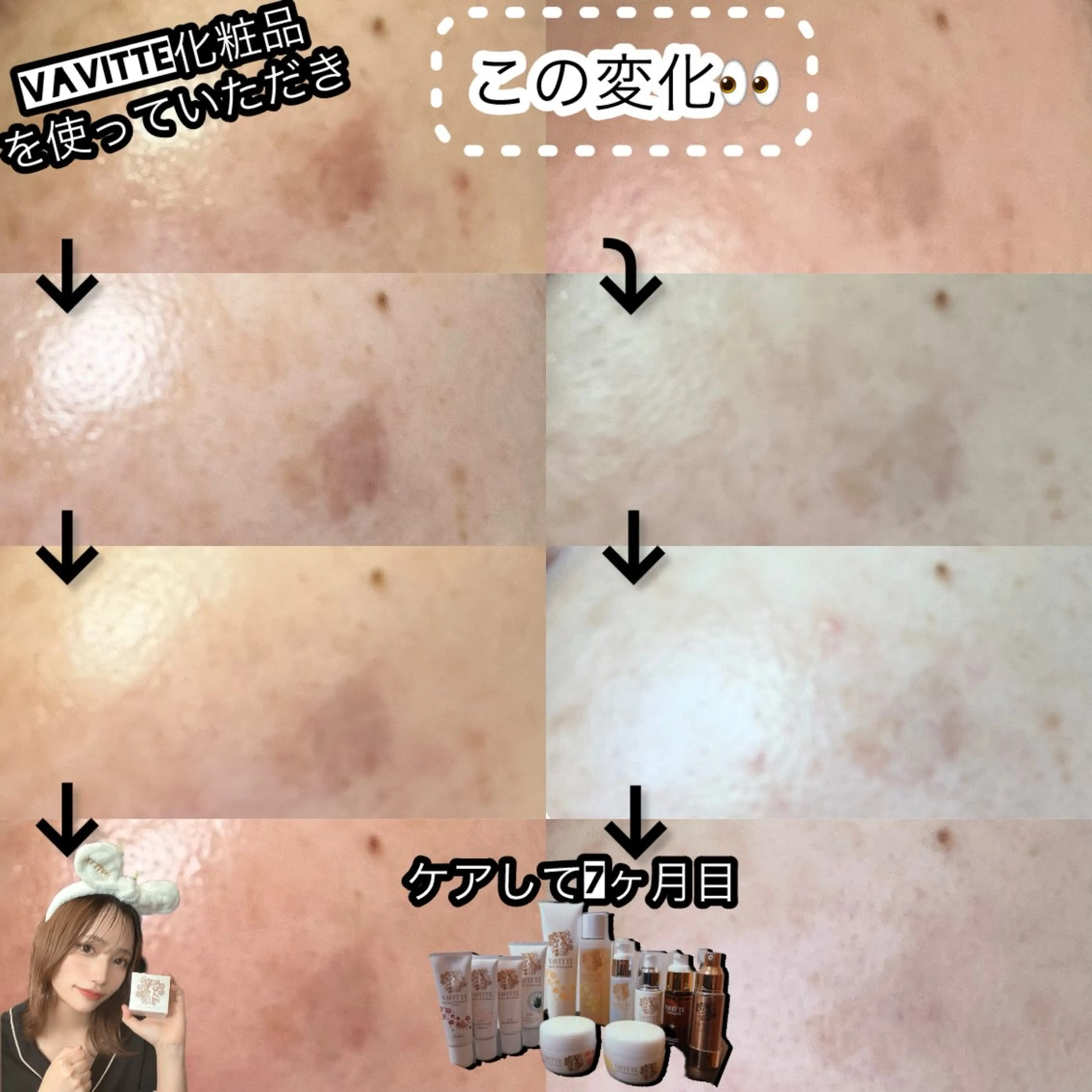 エステ La BeIIe vie所属・LaBeIIevie ラベルヴィのマツエク・マツパデザイン