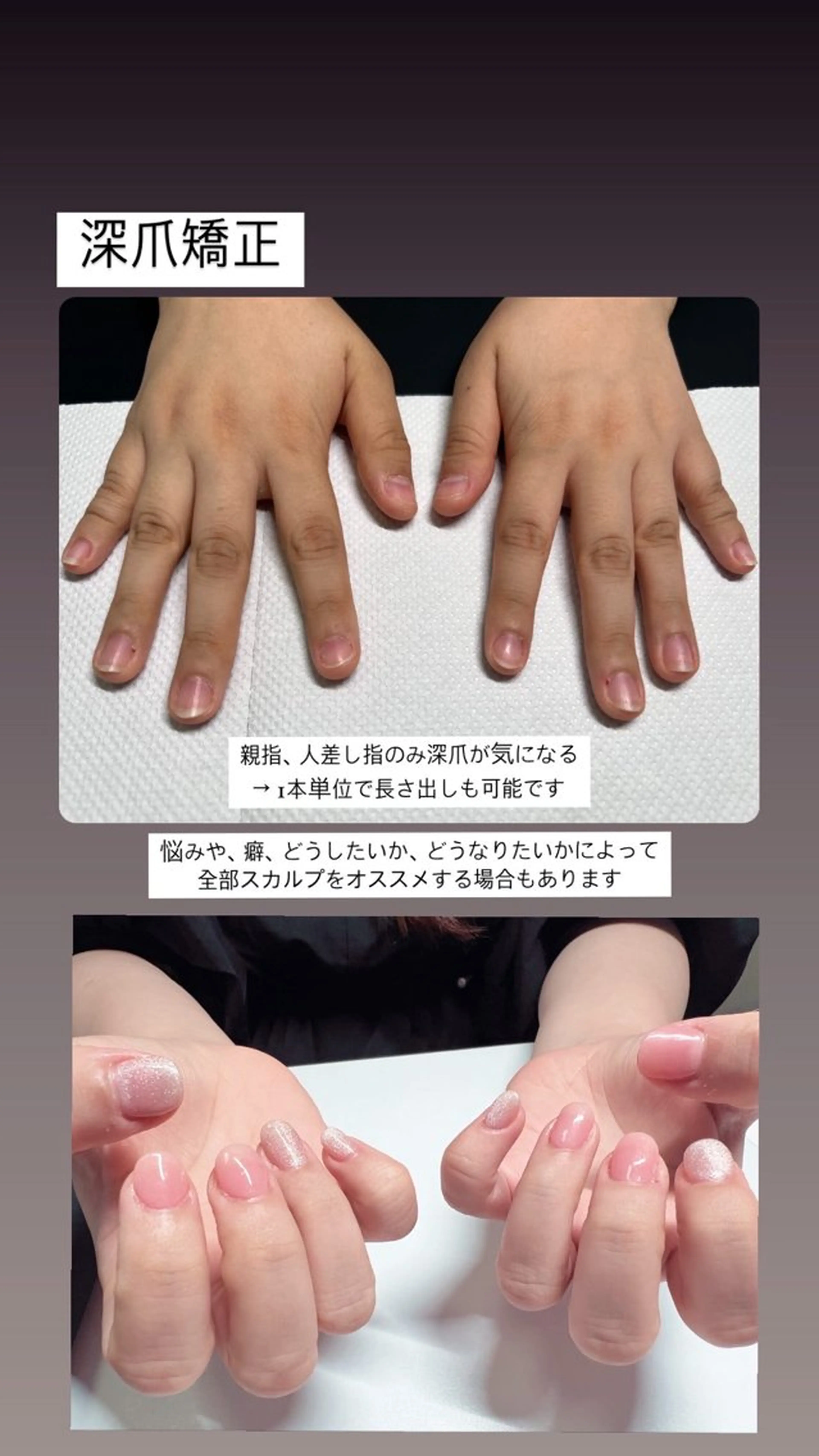 メンズ ネイル 爪ケア/深爪 自爪育成 🐰えむのネイルデザイン