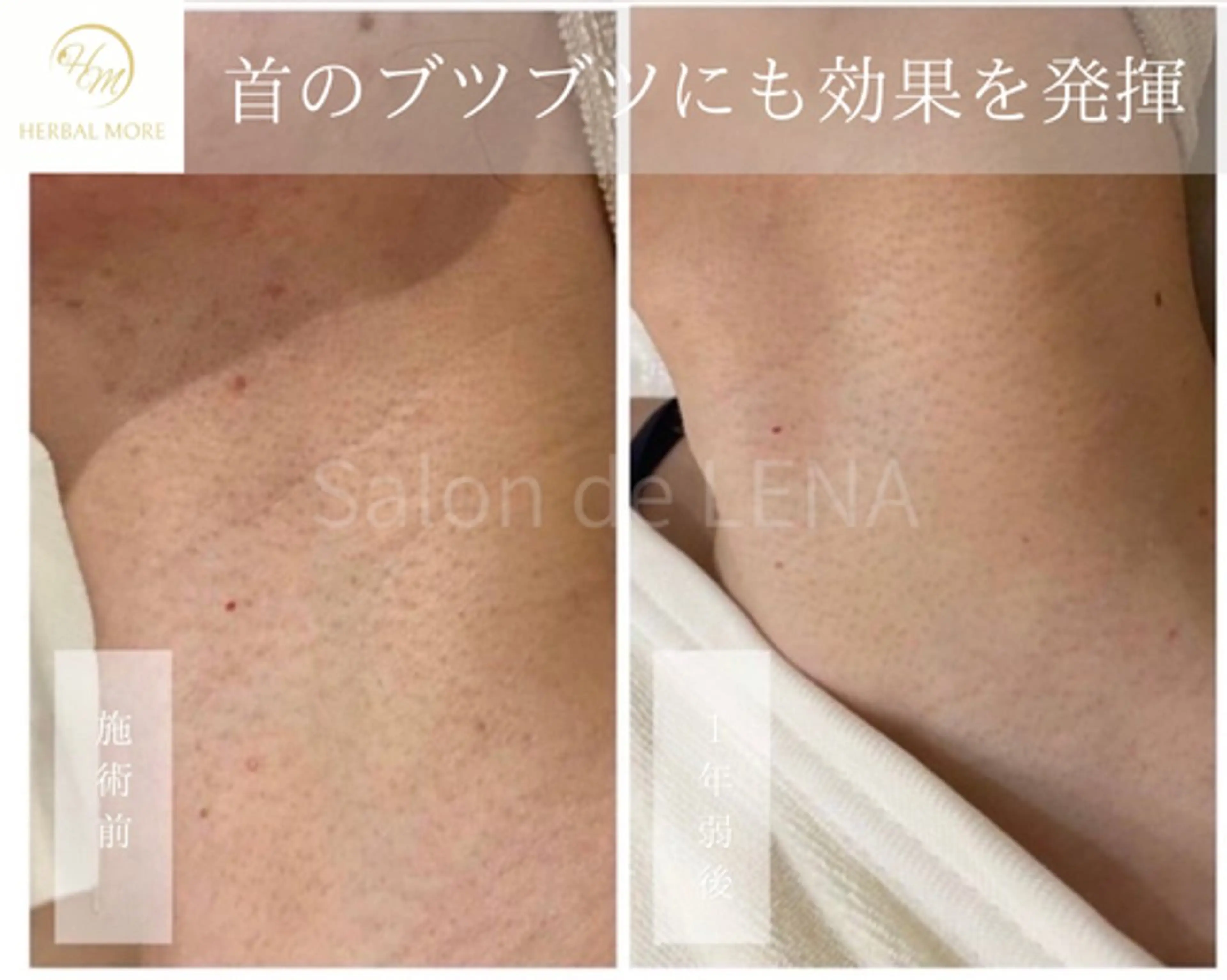 ハーブピーリング・毛穴ケア専門サロンSalon de LENA 栄店所属・ハーブピーリング専門 サロンドレナ　白藤のエステ・リラクイメージ