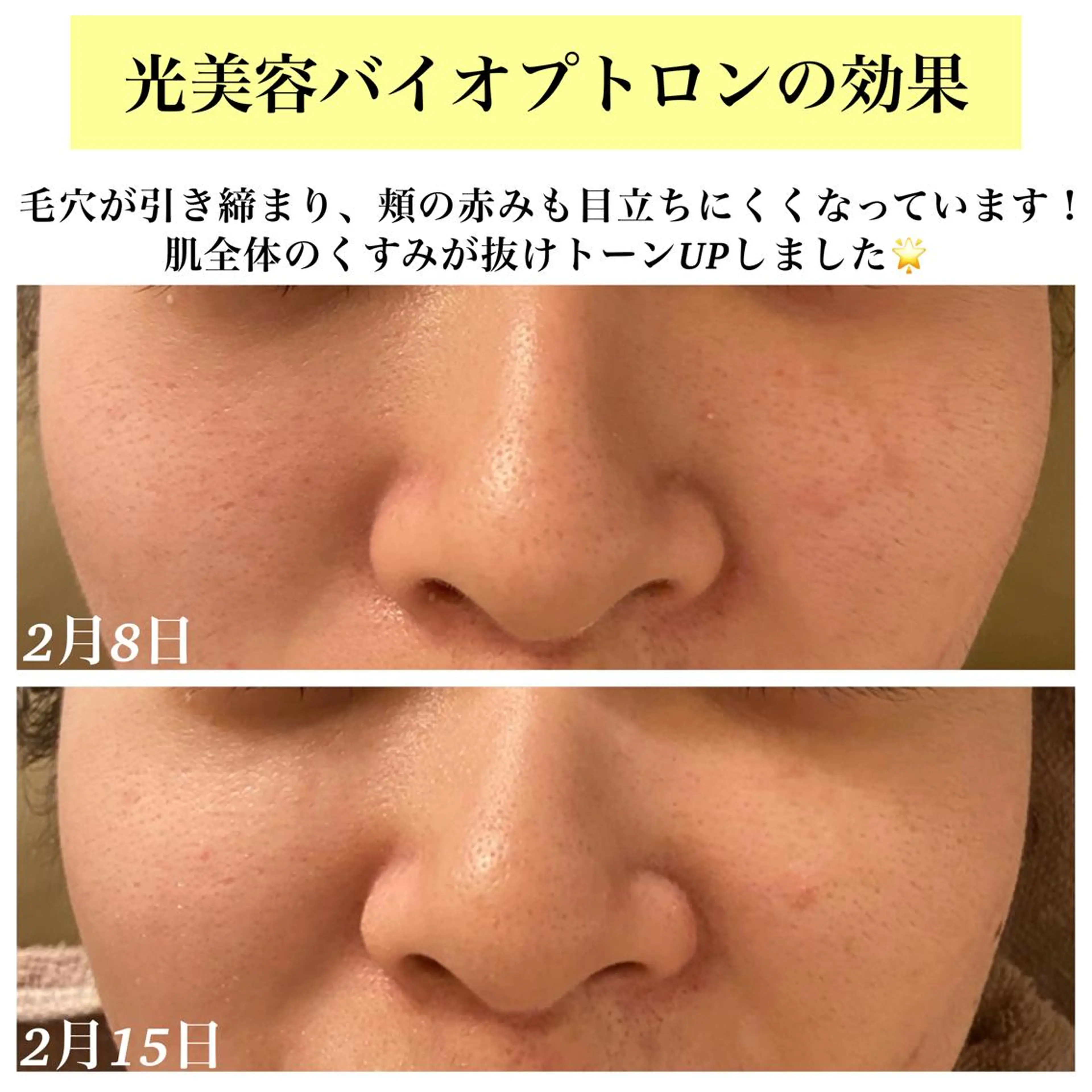 Bellesthe (ベルエステ)のエステ・リラクイメージ