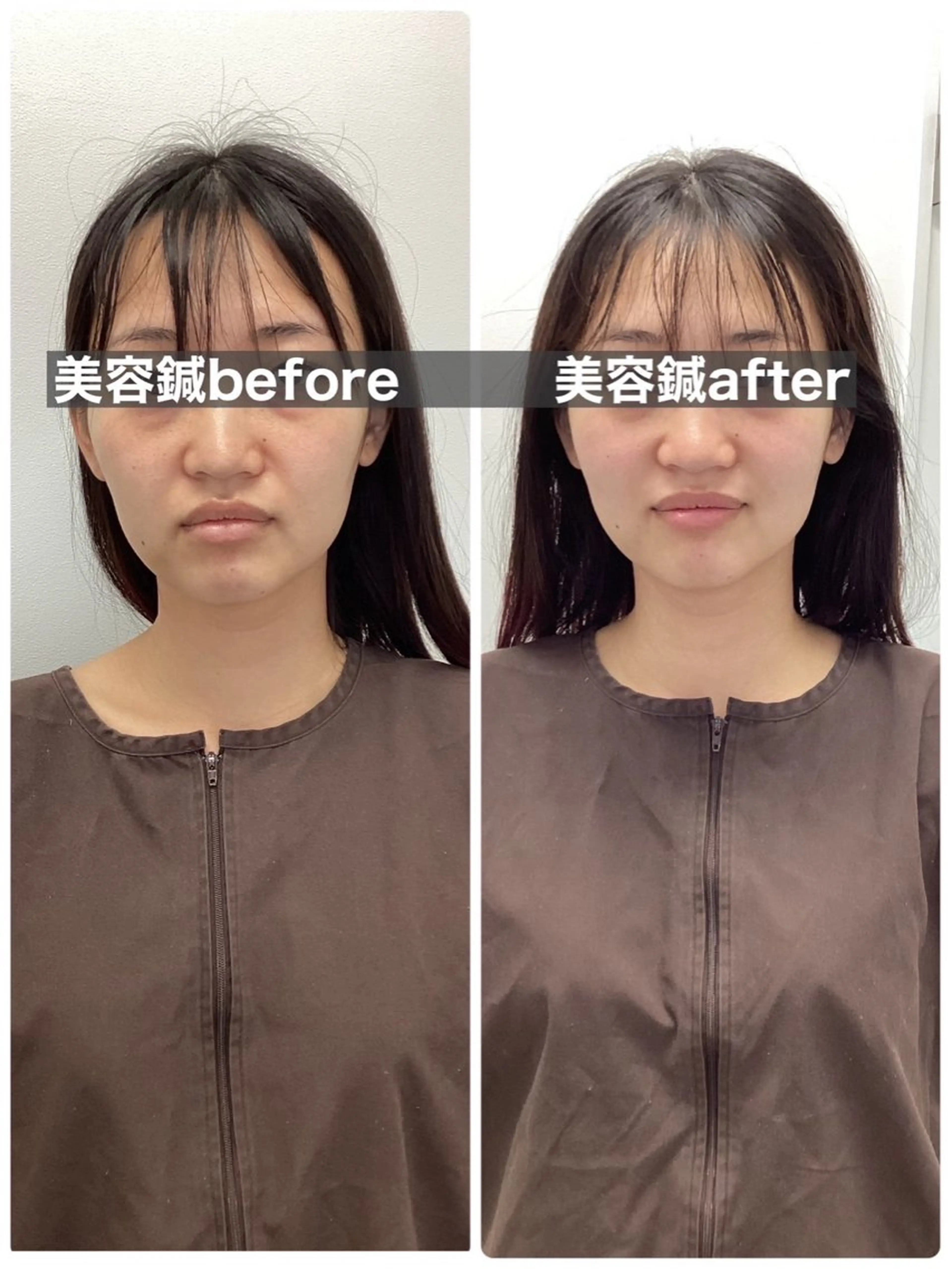 hari salon de off　美容鍼灸×小顔整体【ハリサロンドオフ】所属・美容鍼灸×小顔整体♡ ハリサロンドオフ堺東のエステ・リラクイメージ