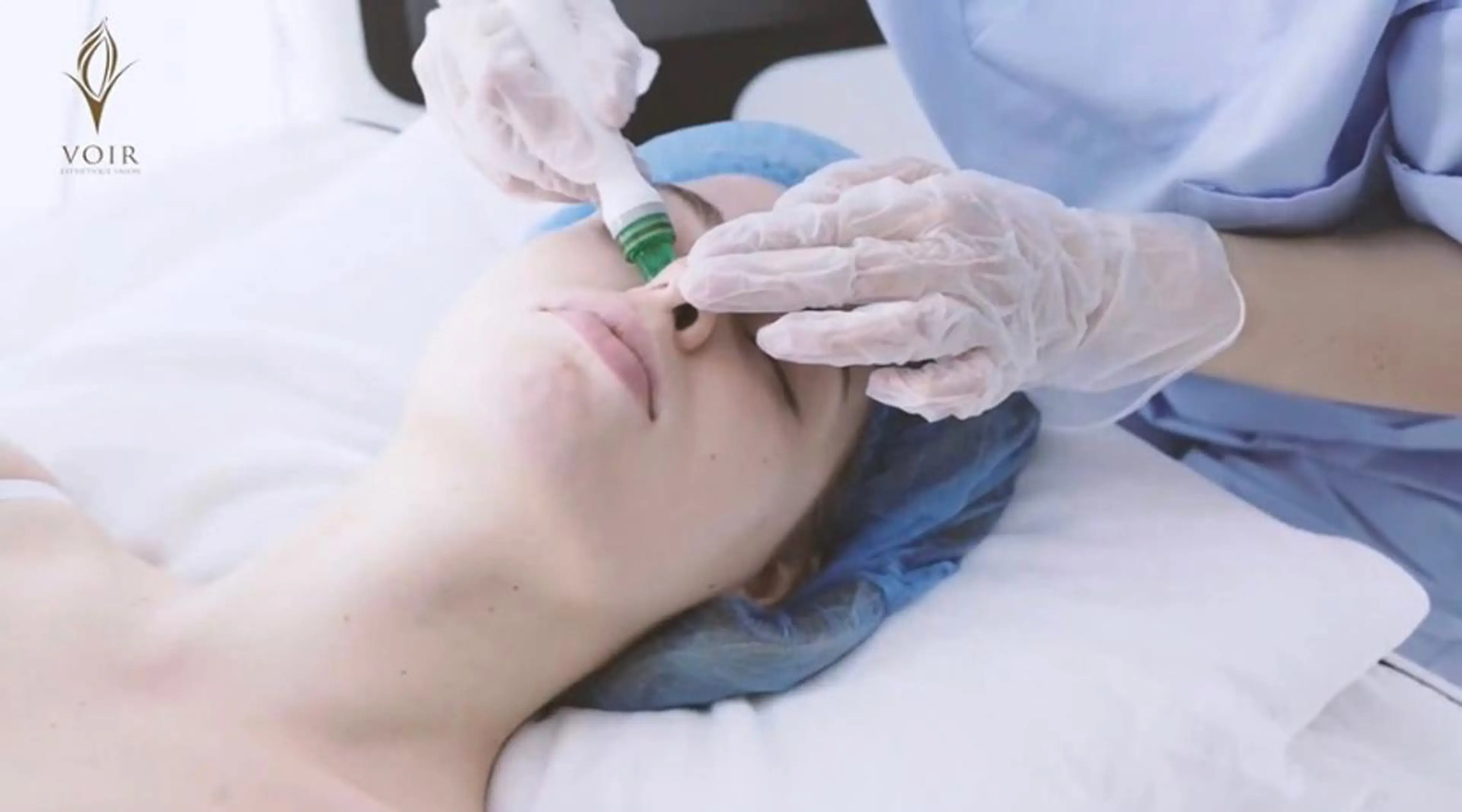 いちご鼻🍓おさらば👋ハイドラフェイシャル💙の写真