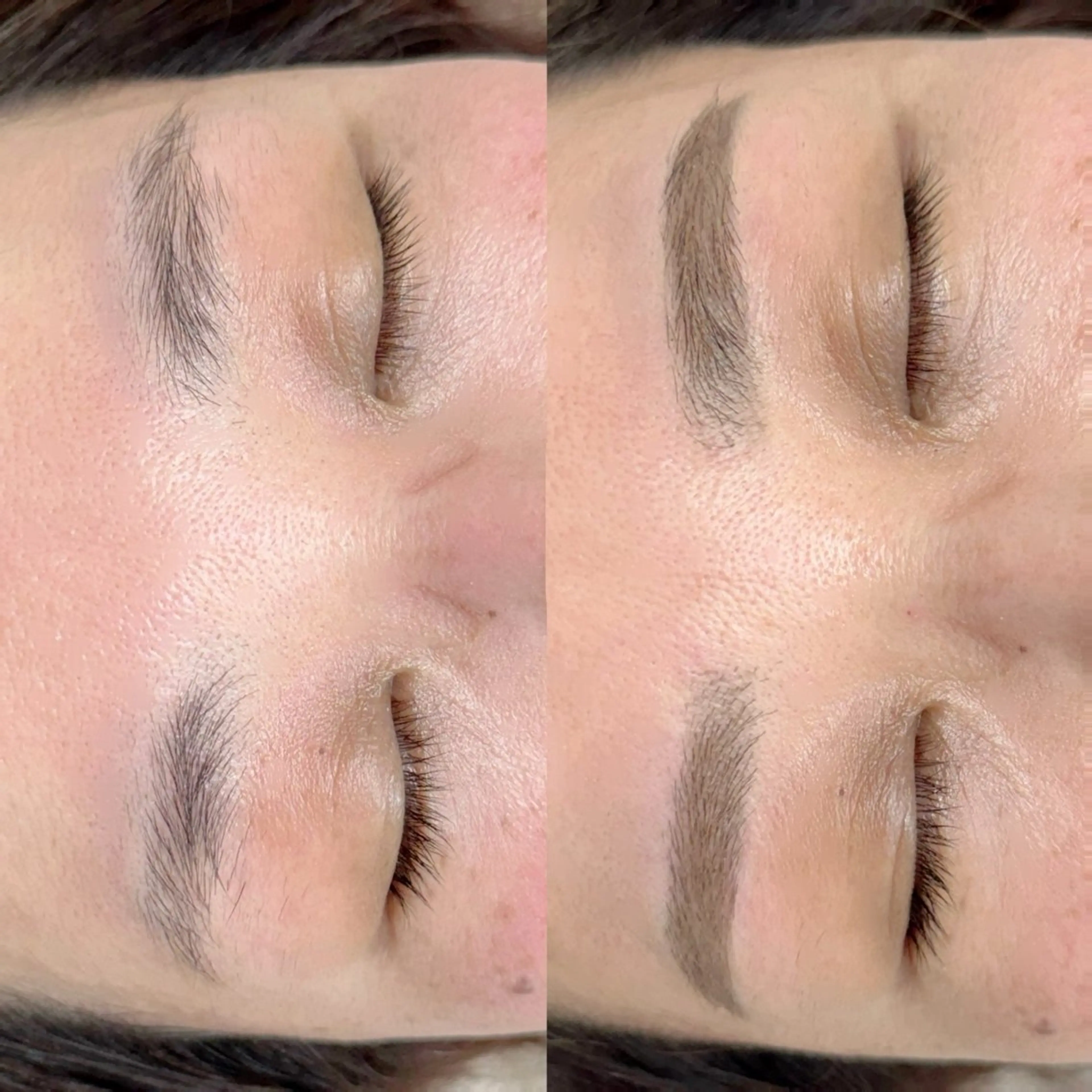 日にち限定🎀ワックス脱毛の写真