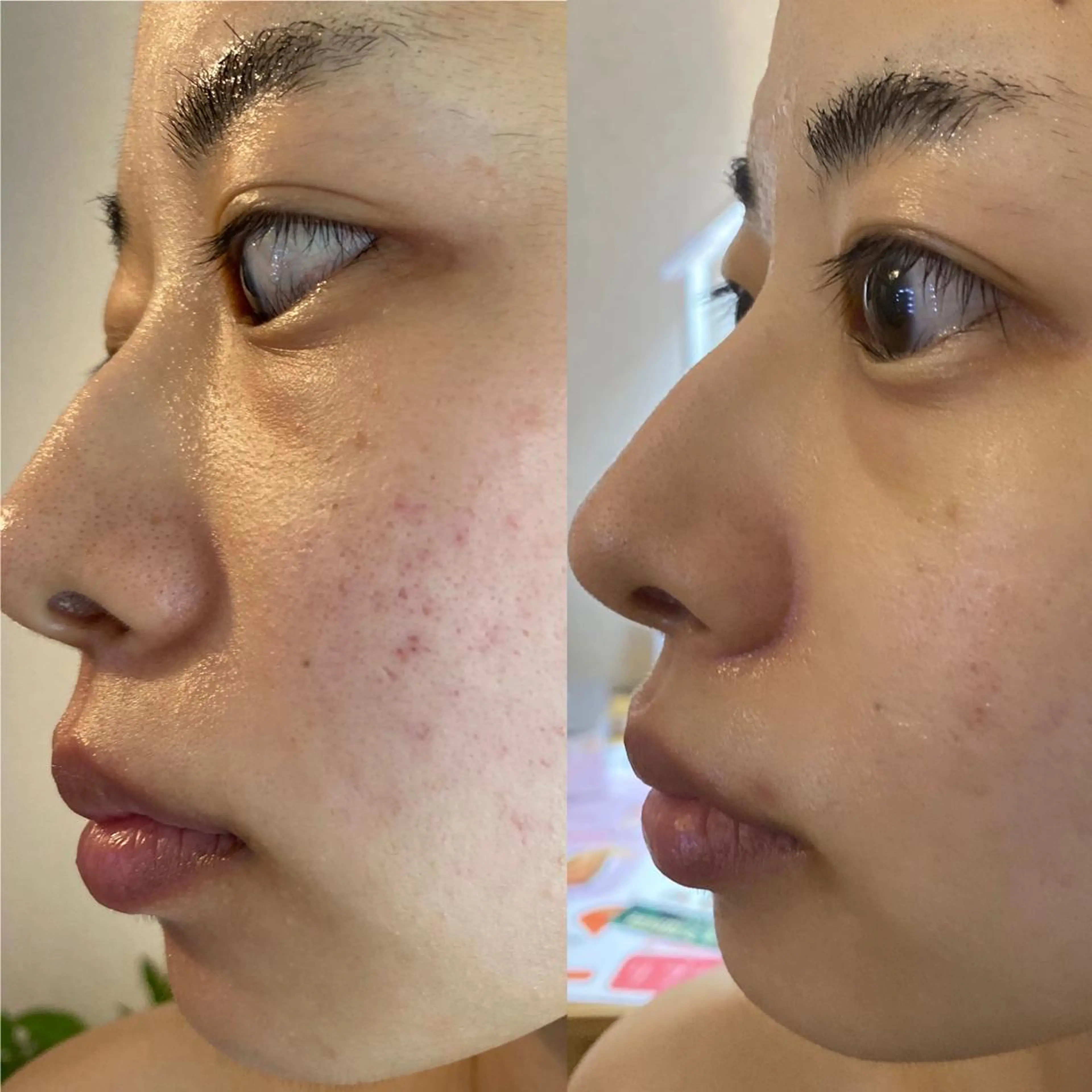 Meetite 小林のエステ・リラクイメージ