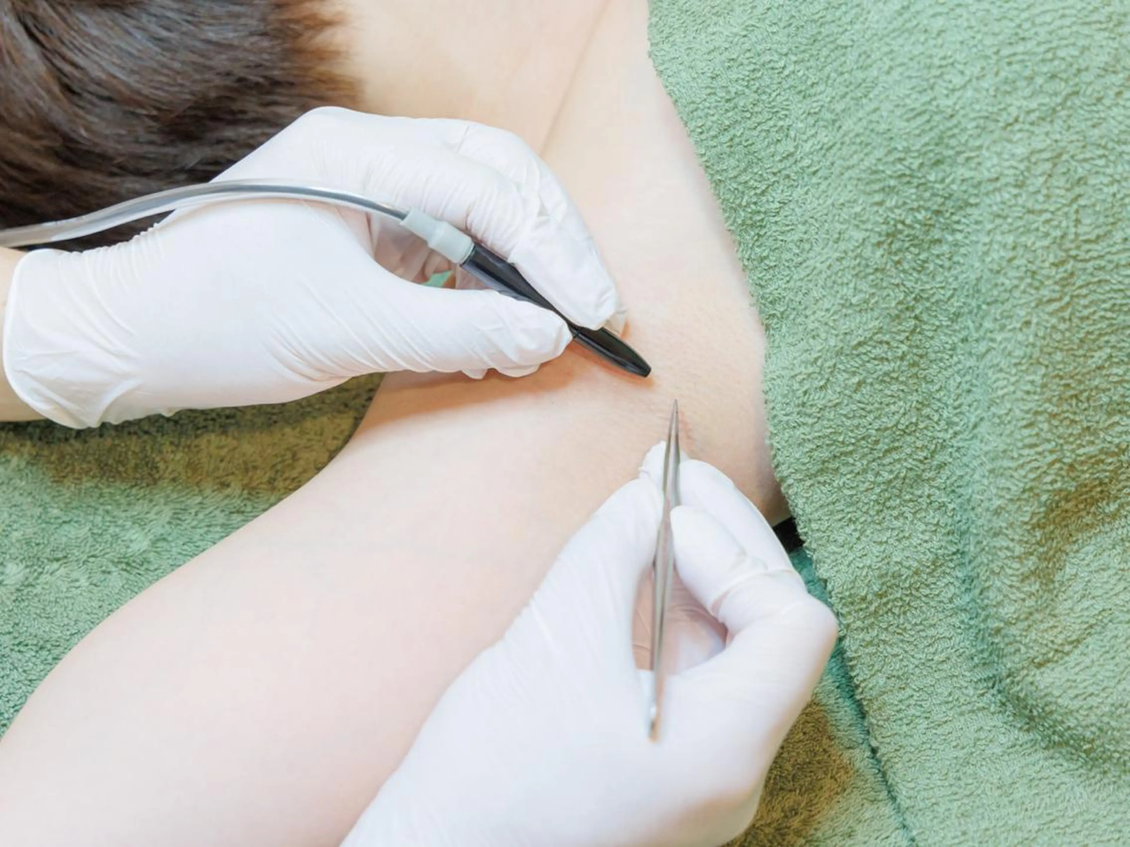 再来5週間以内（ライン友達限定）60分　24,200→12,100の写真