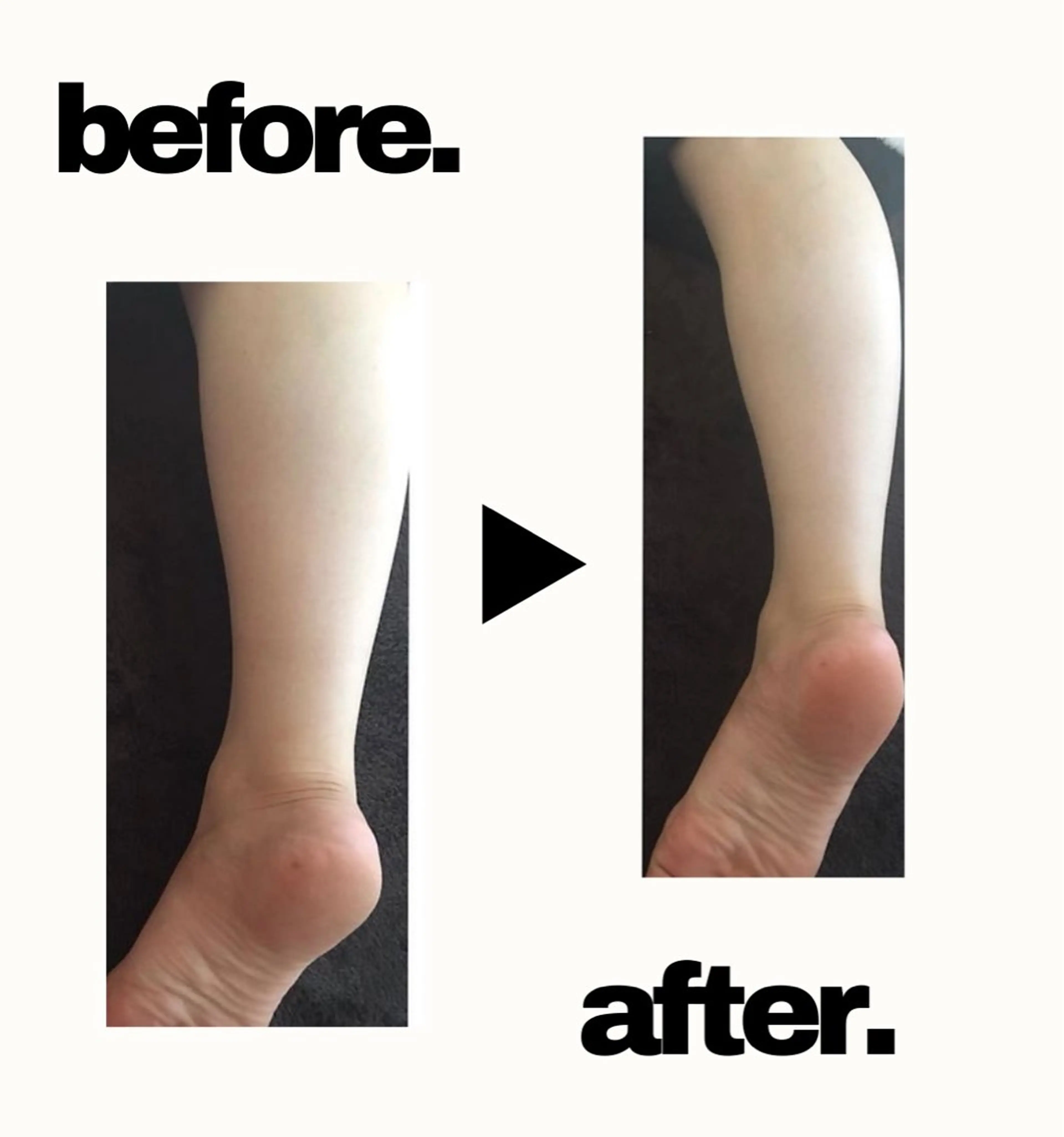 リフレクソロジー《フットバス付》40分の写真