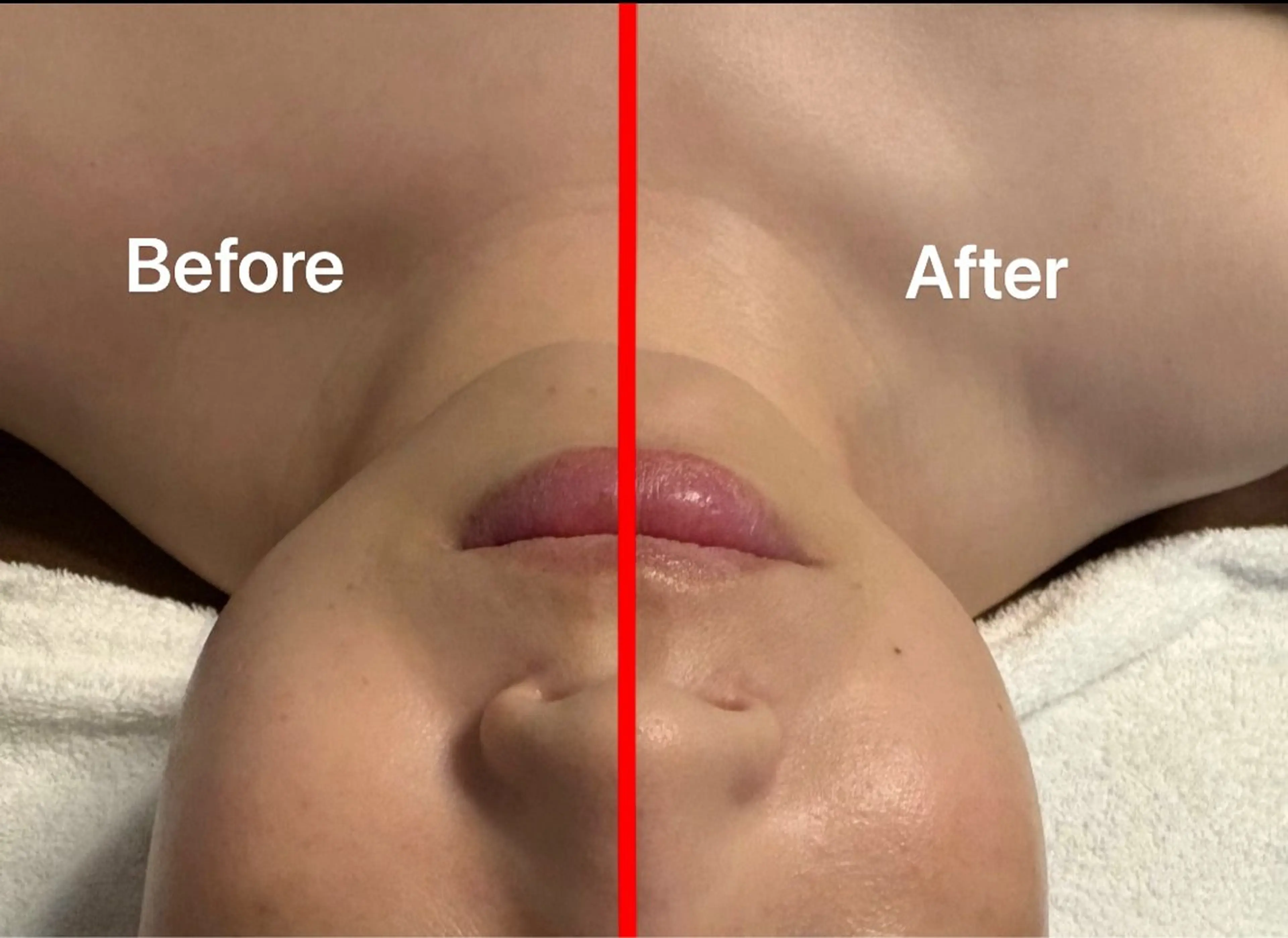 💆♀️フェイシャル💆♀️60分の写真