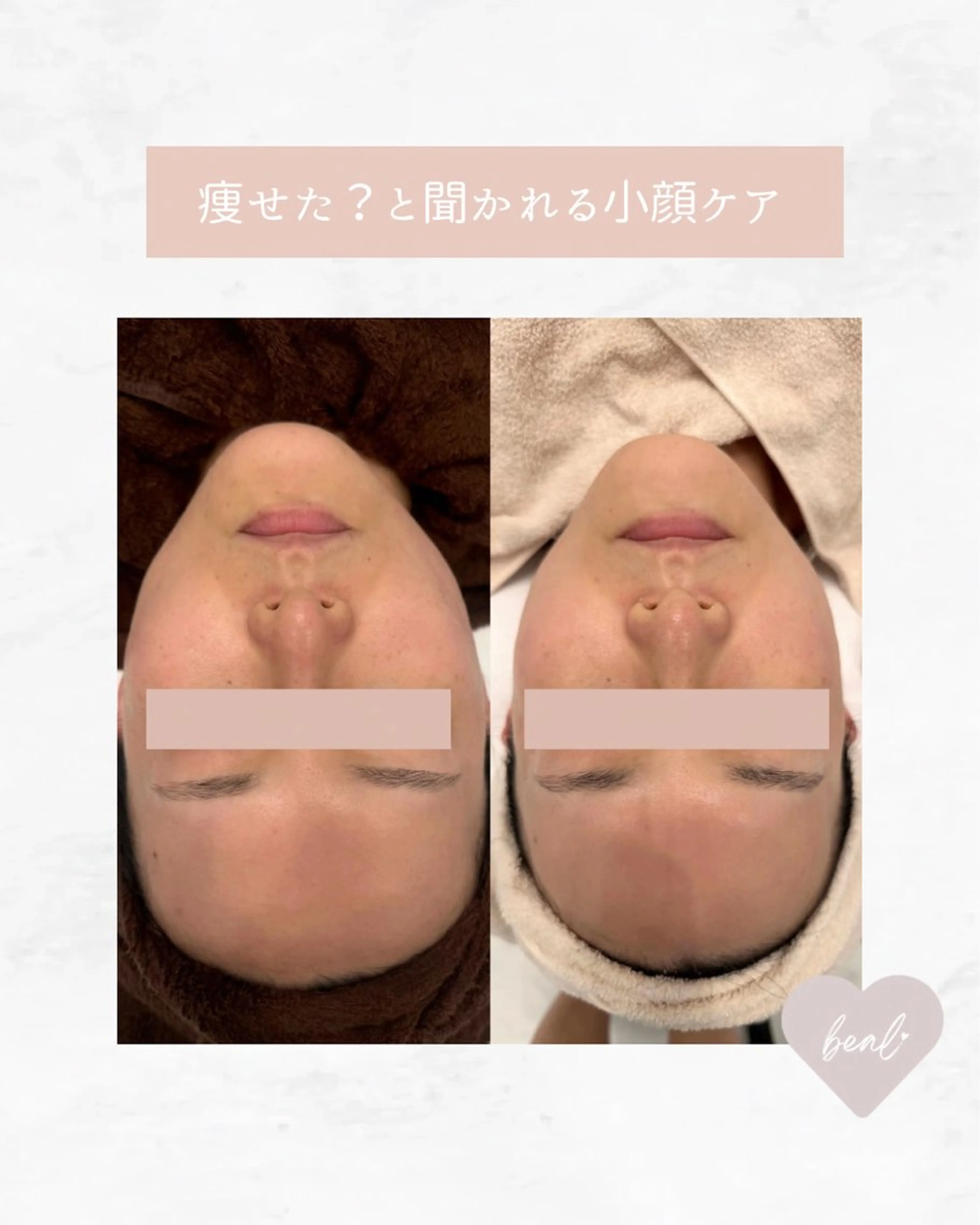 べアール所属・小顔/毛穴/ニキビ salon bealのエステ・リラクイメージ