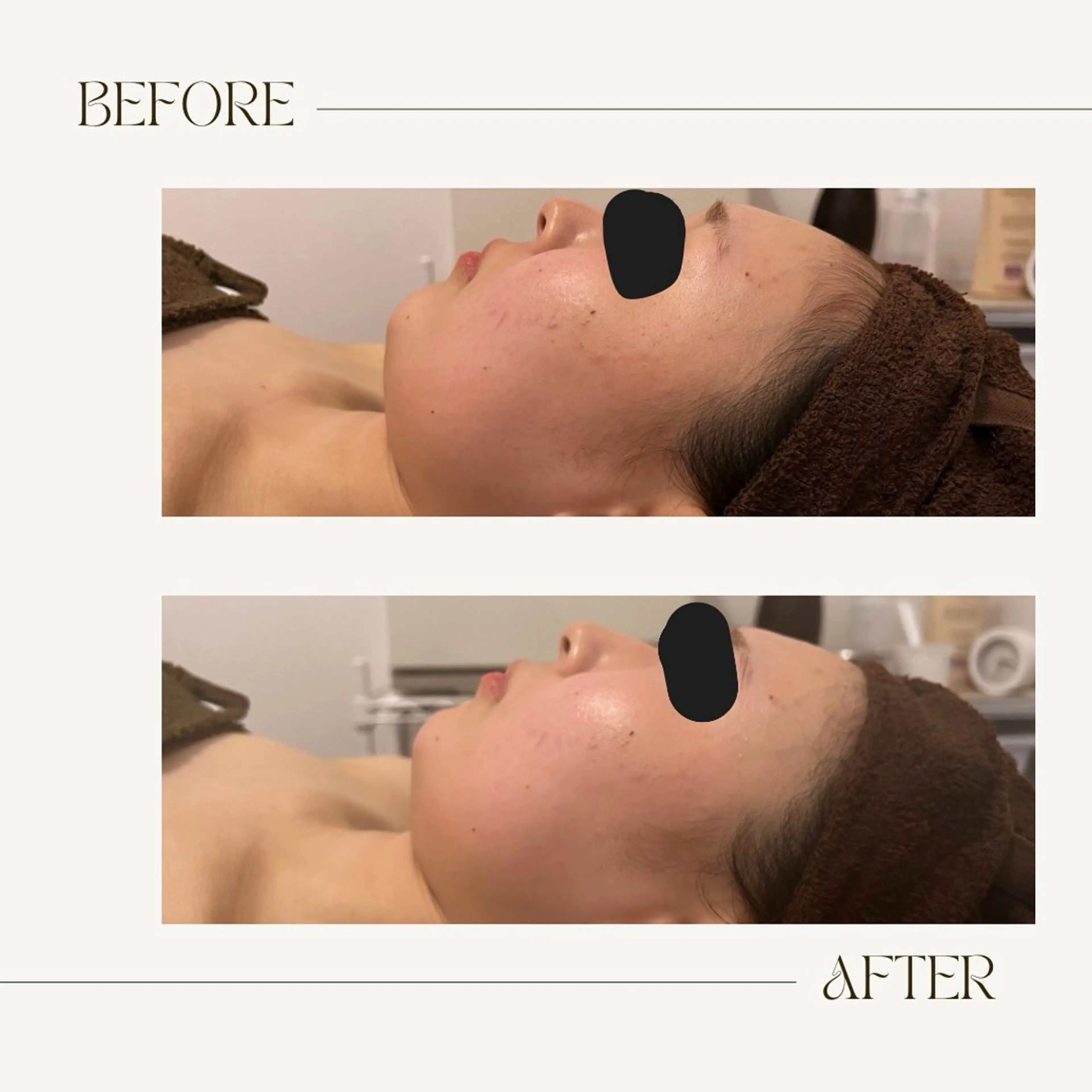 エステ 骨気&Relaxation Vivian 名駅所属・遠藤 芹華のエステ・リラクイメージ