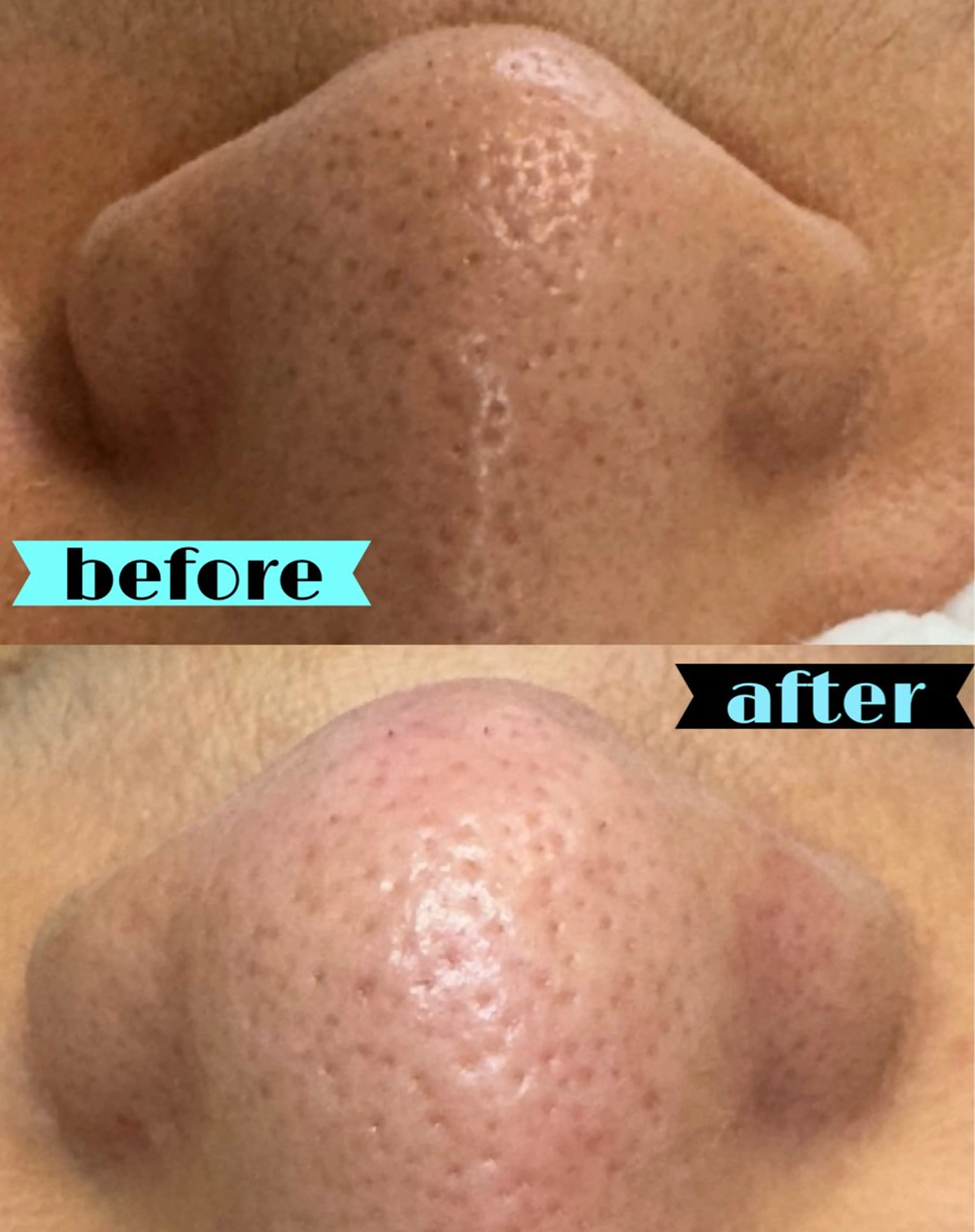 毛穴専門サロン ライカブルーのエステ・リラクイメージ