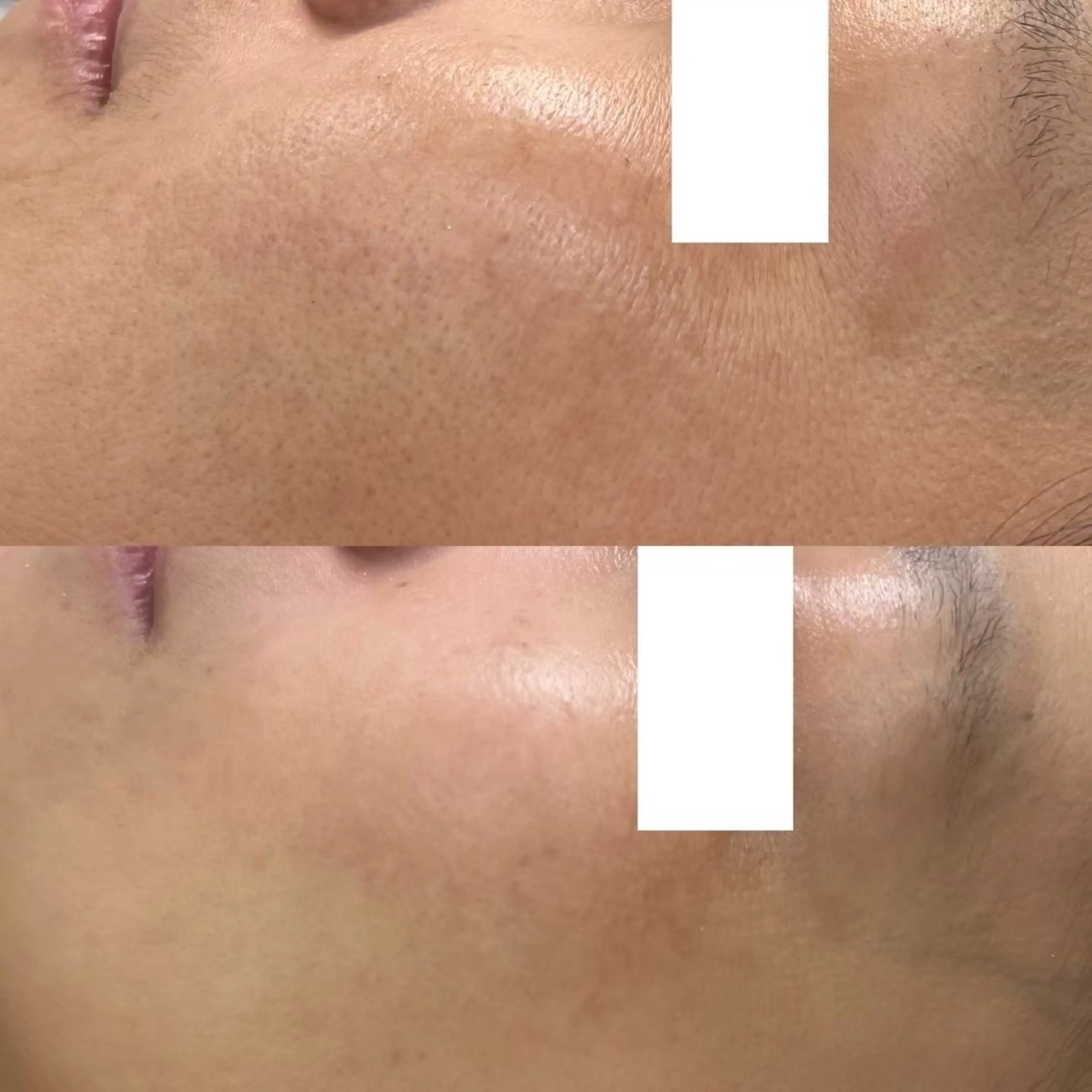 Les Prages（プラージュ）所属・サロン プラージュのエステ・リラクイメージ