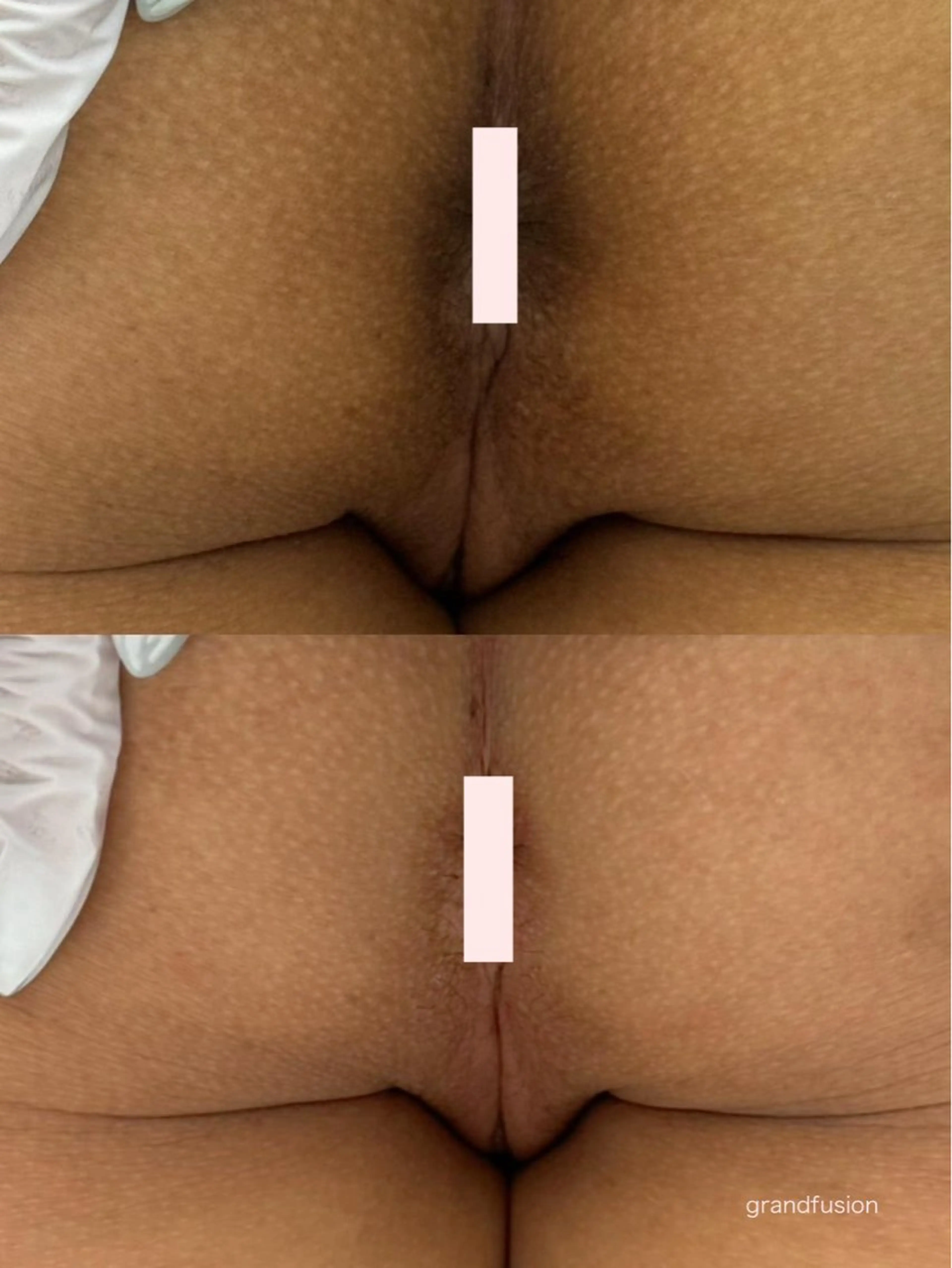 本気で痩せたい方へ 痩身専門サロンのエステ・リラクイメージ