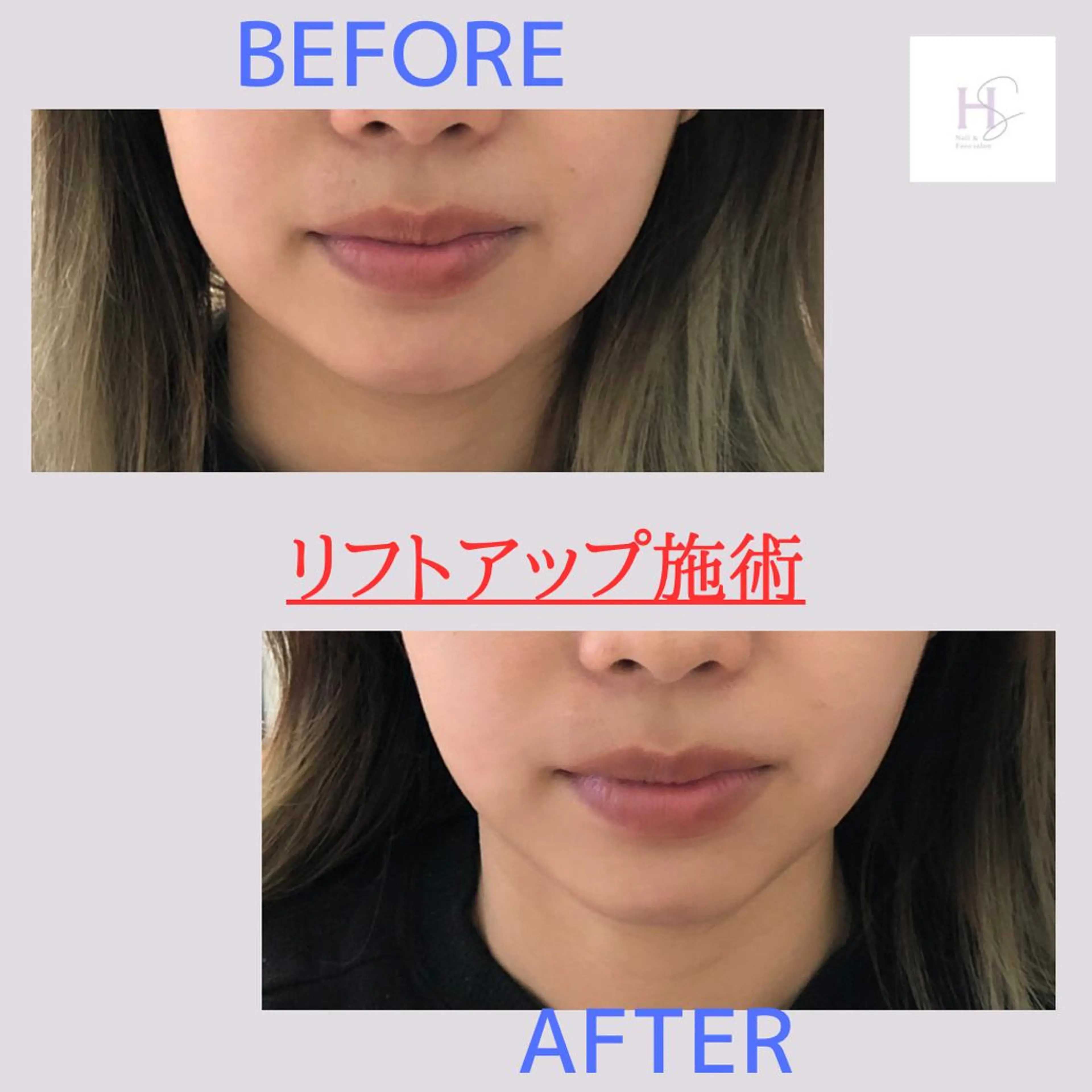 小顔・ツルツル素肌 ハリステリアのエステ・リラクイメージ