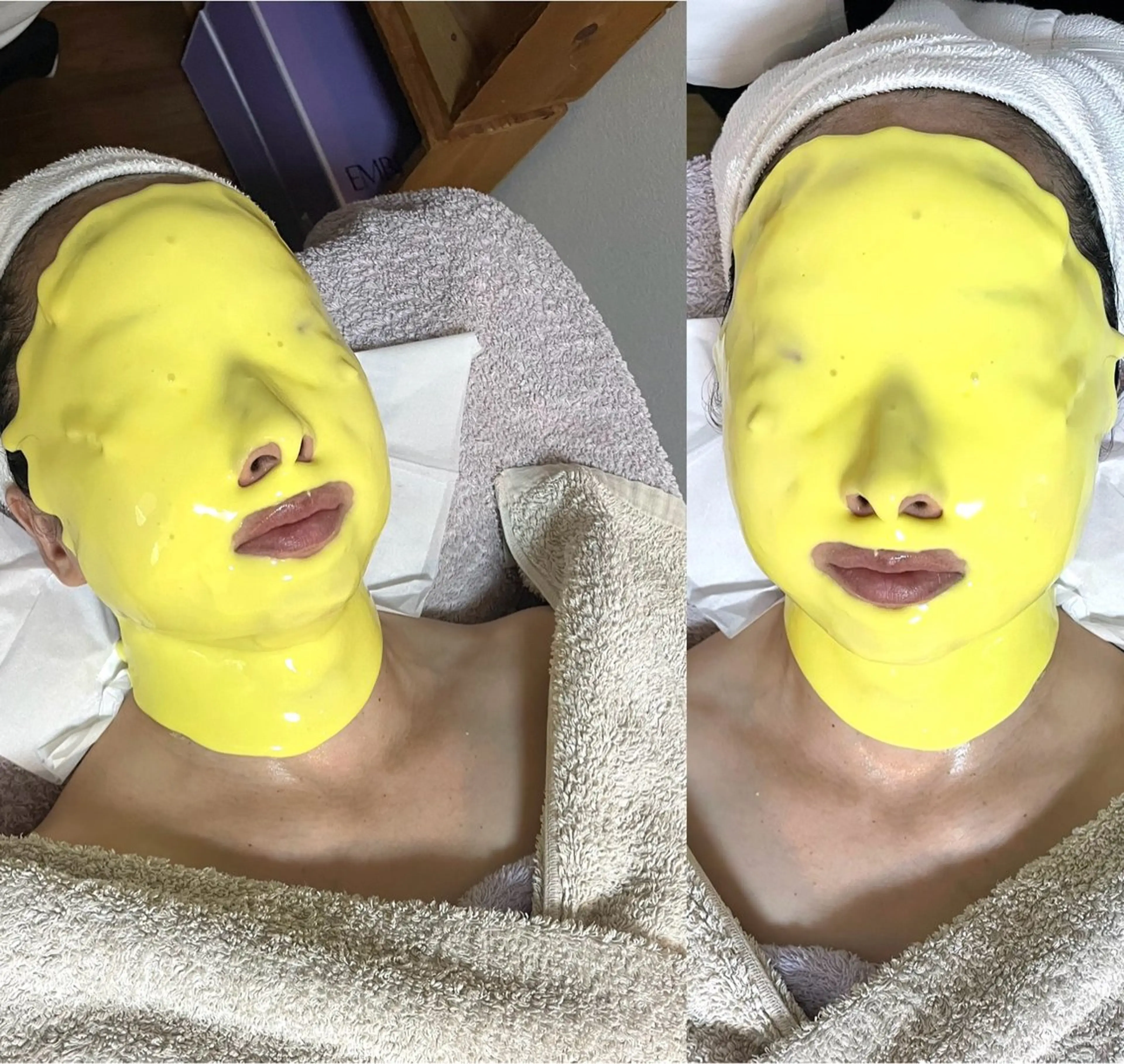 ◎肌の変化が気になる方◎ダブルビタQパック(20分2200円)付きフェイシャル アドバンスコースの写真