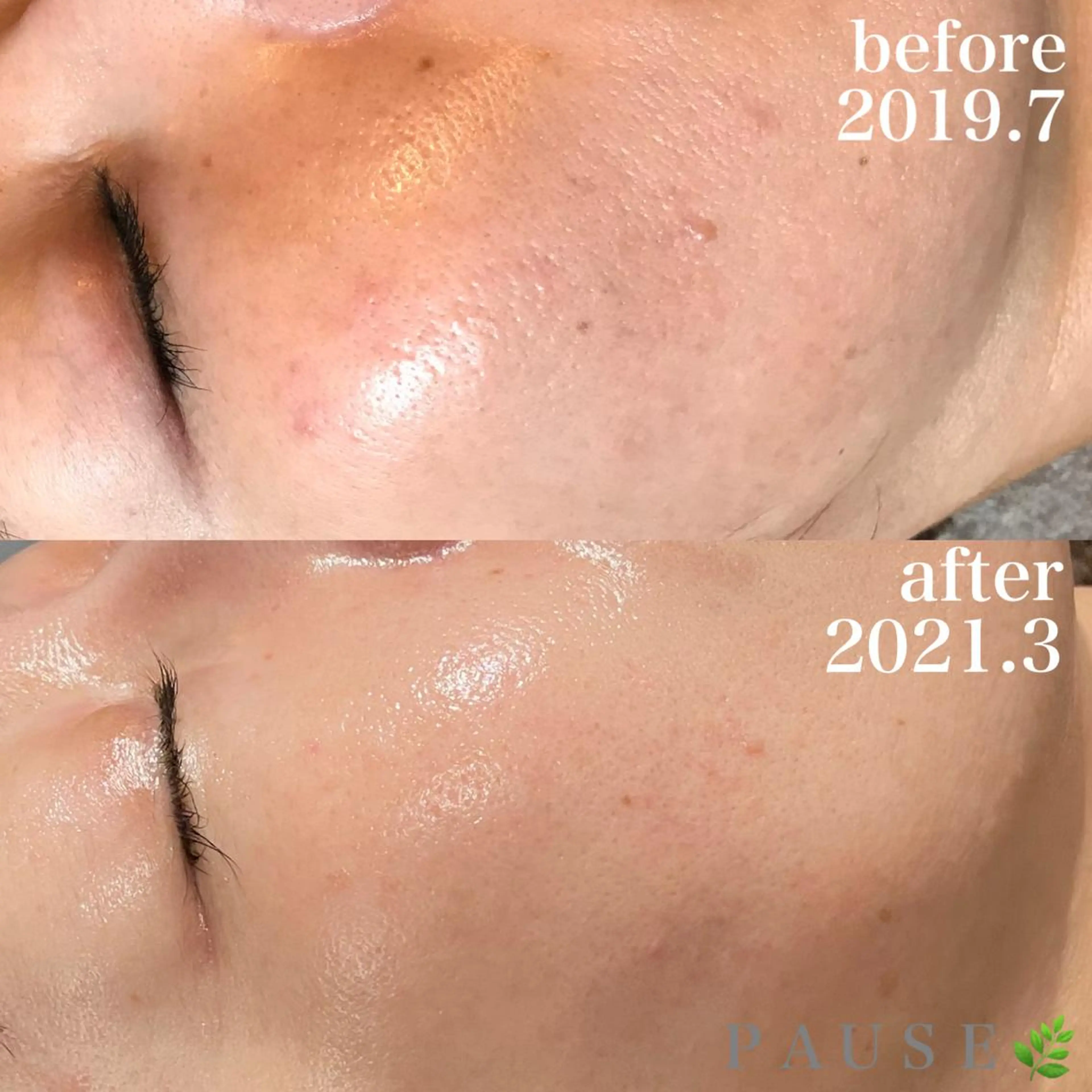 エステ 浜野 恵美のエステ・リラクイメージ