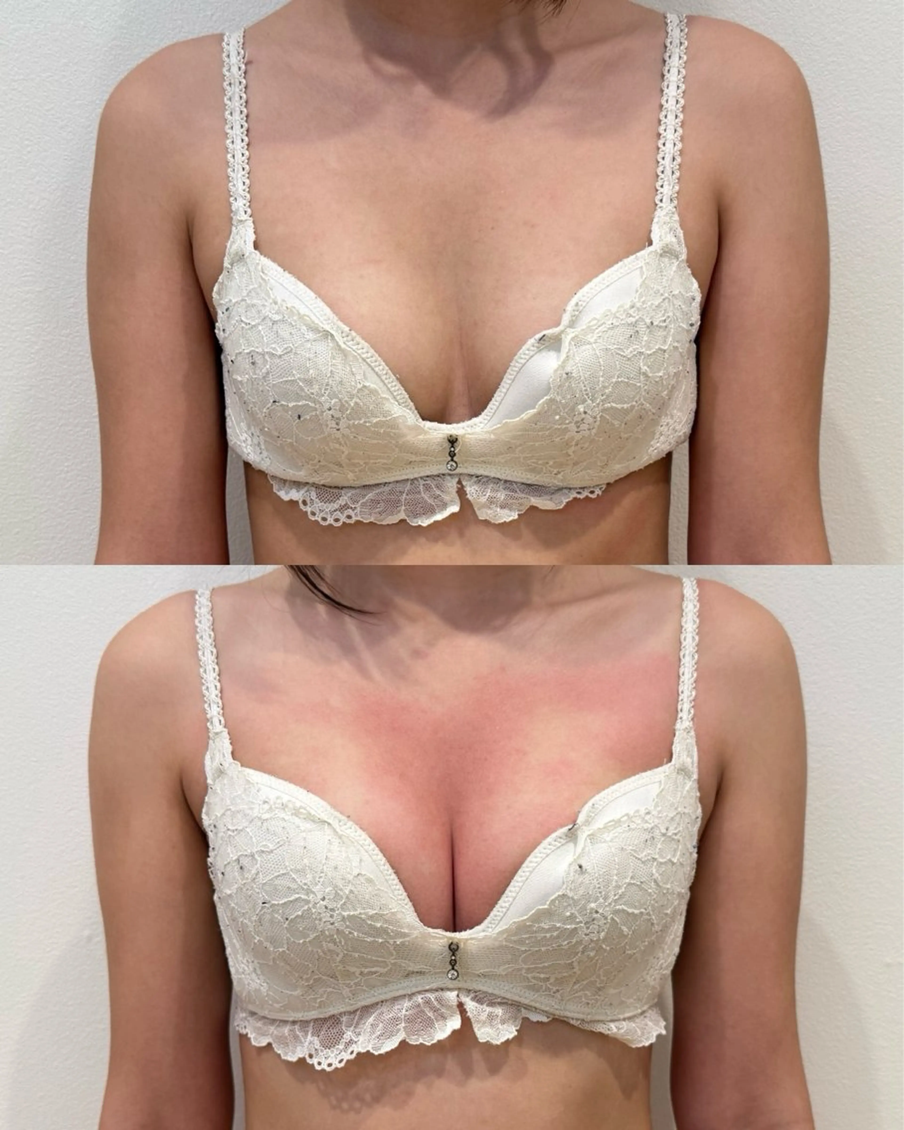 エステ beautysalon RAVIS所属・東大阪/韓国肌管理/ 痩身バスト専門店のエステ・リラクイメージ