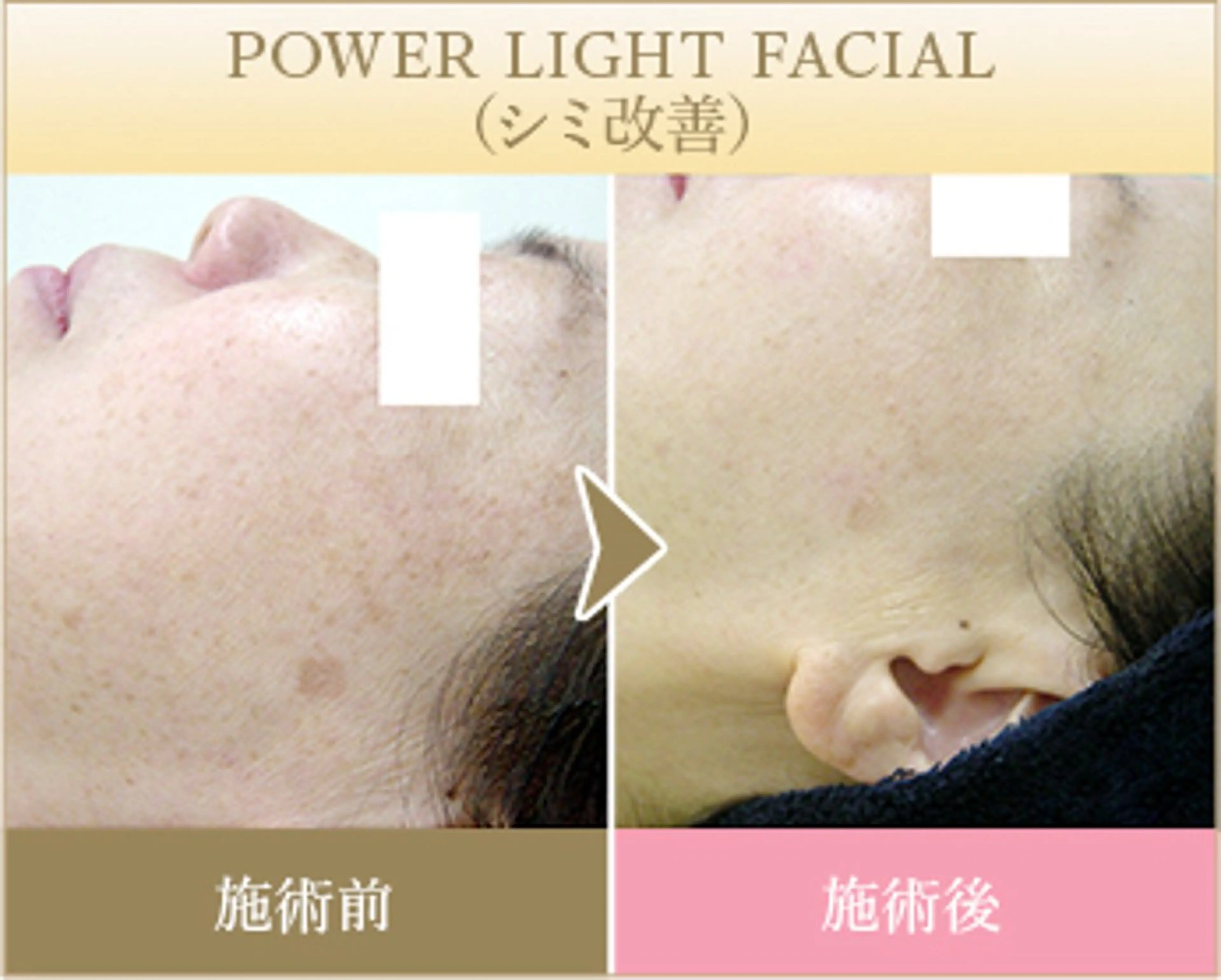 ˚⟡ suwan .˚⟡のエステ・リラクイメージ