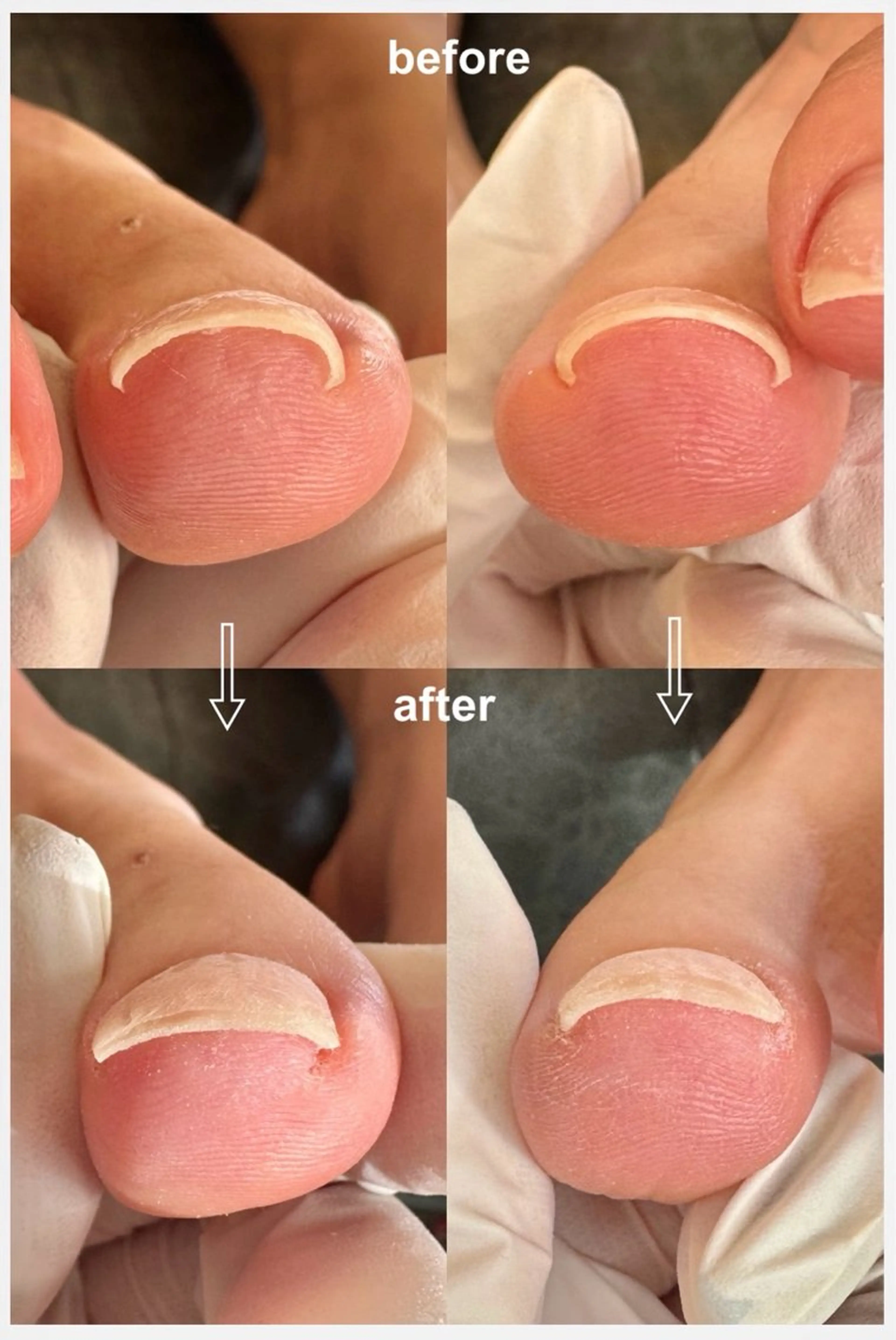 ネイル Sasaki Chiyokoのネイルデザイン