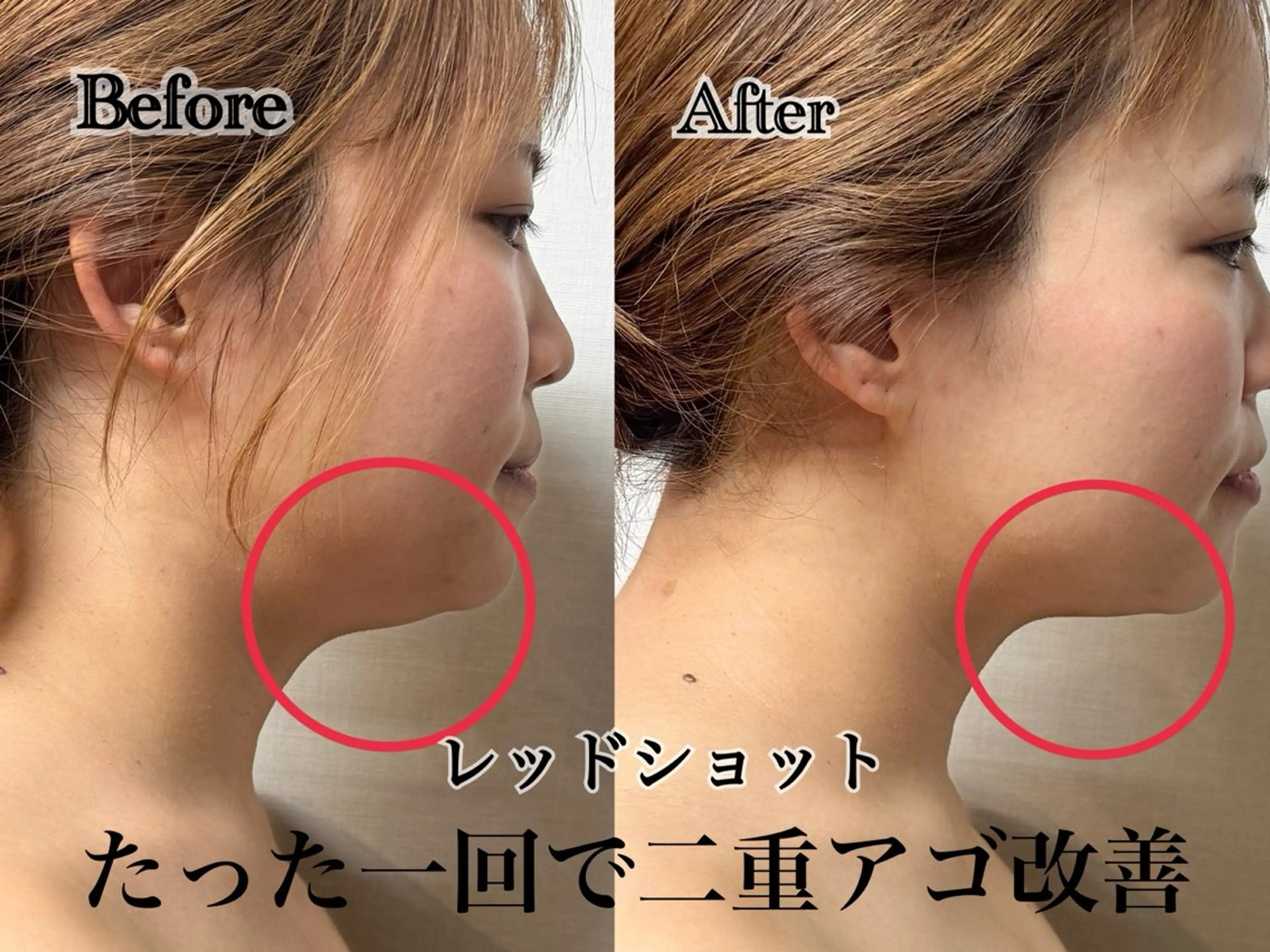 エステ 六本木脱毛andS 店長Sachiのエステ・リラクイメージ