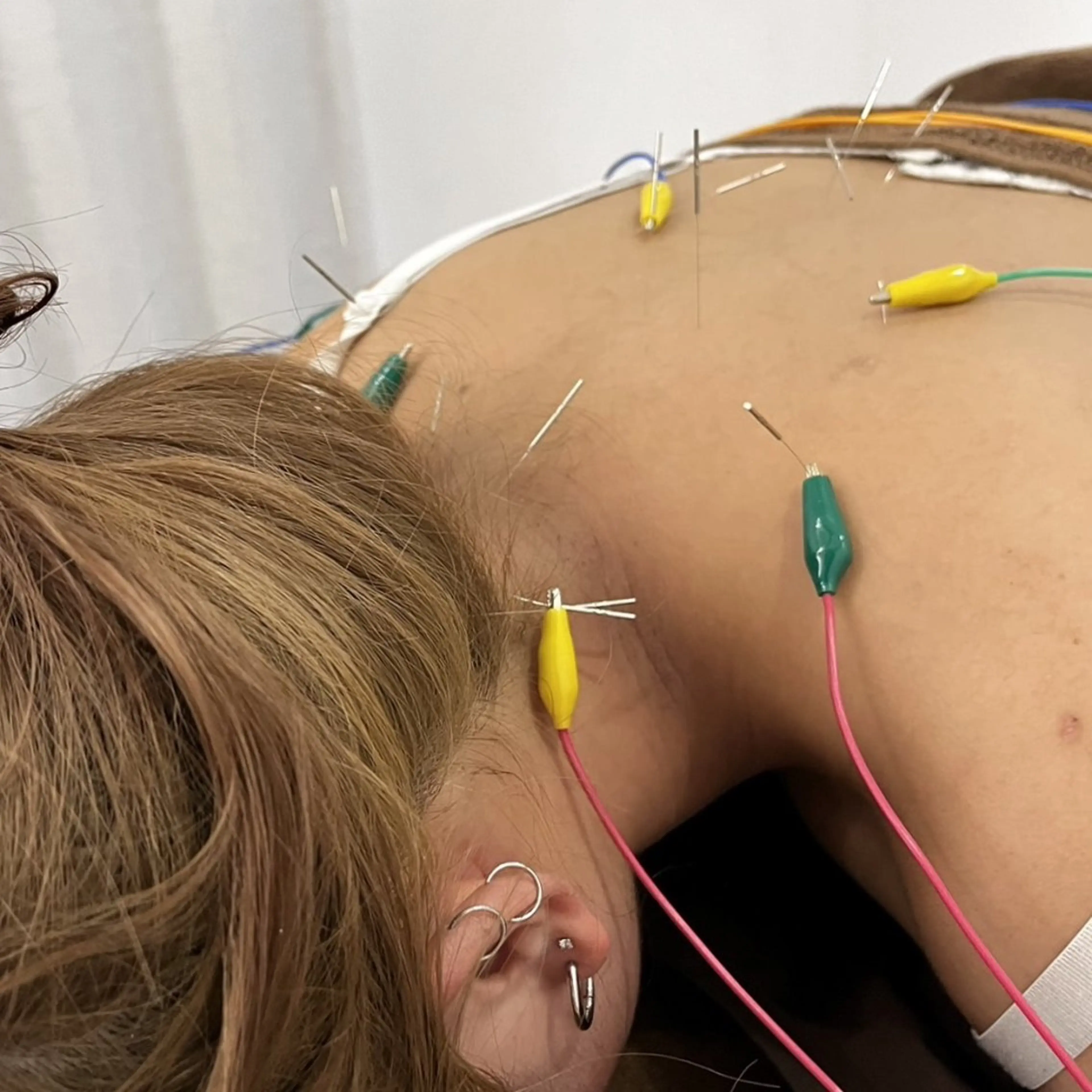 エステ リラク Spring鍼灸院所属・Spring鍼灸院 ✨首肩こり、腰痛に！のエステ・リラクイメージ