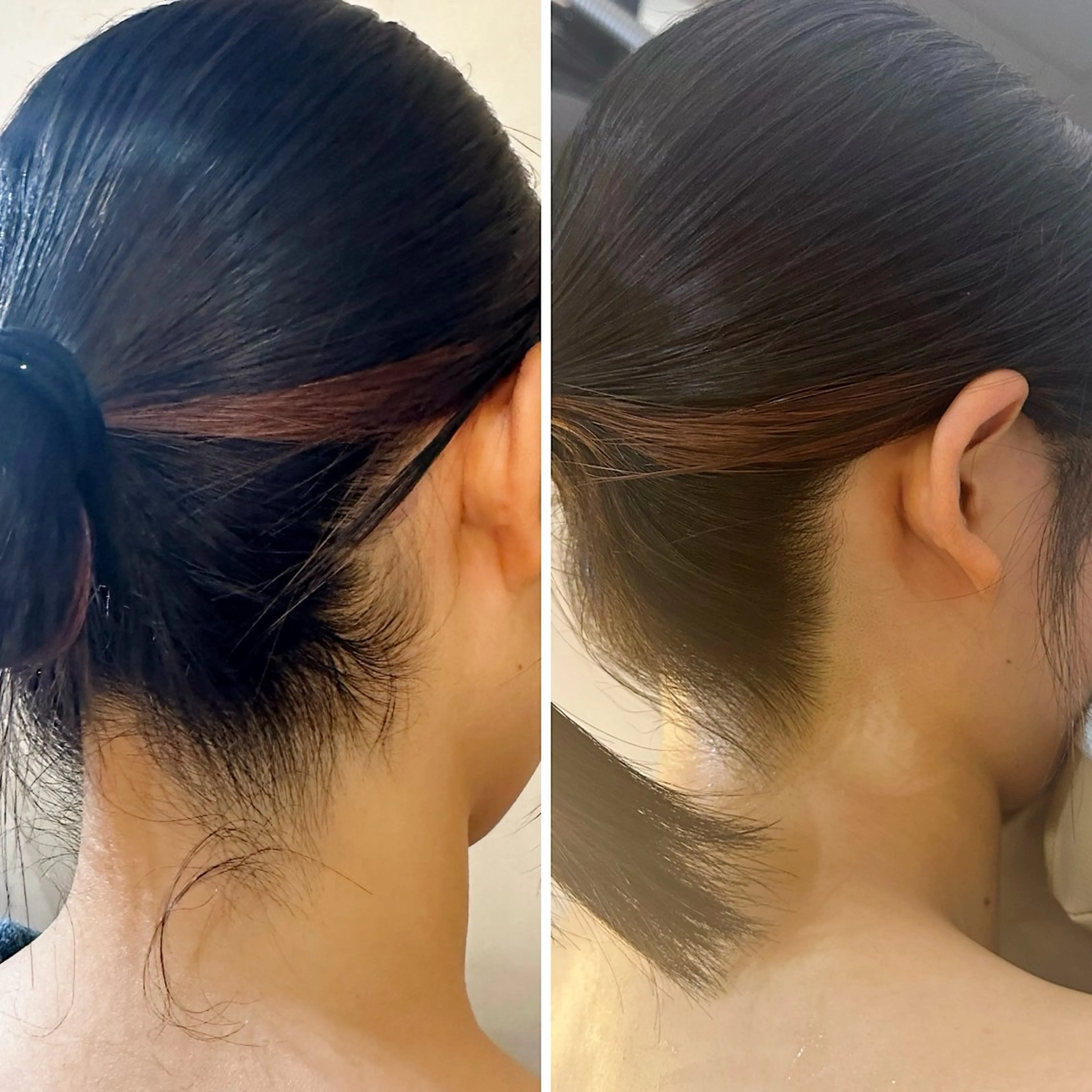 脱毛 うなじ脱毛/美肌脱毛 LABELのエステ・リラクイメージ