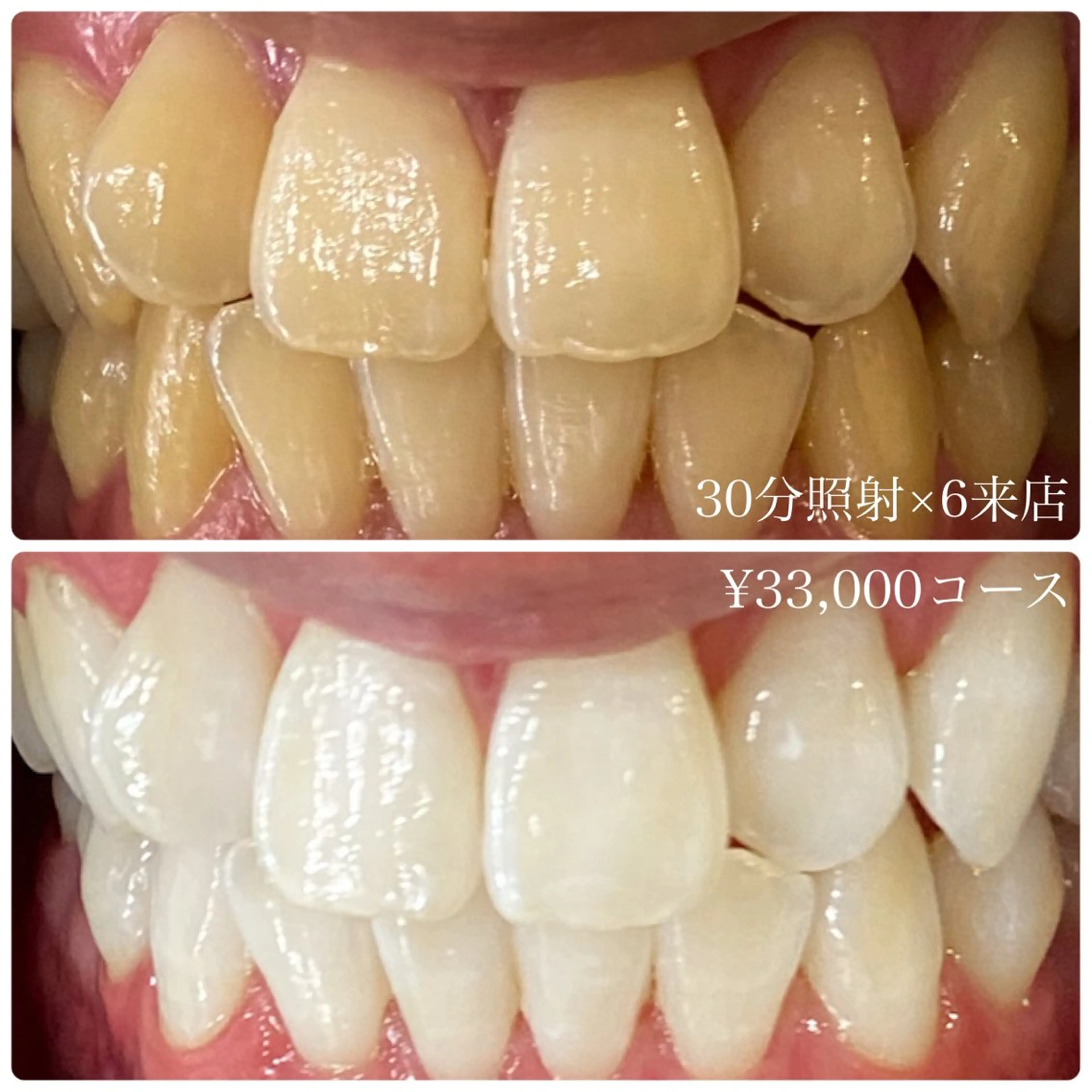 メンズ その他 ホワイトニングルーム　川崎店所属・ホワイトニング ルーム　川崎店のその他イメージ