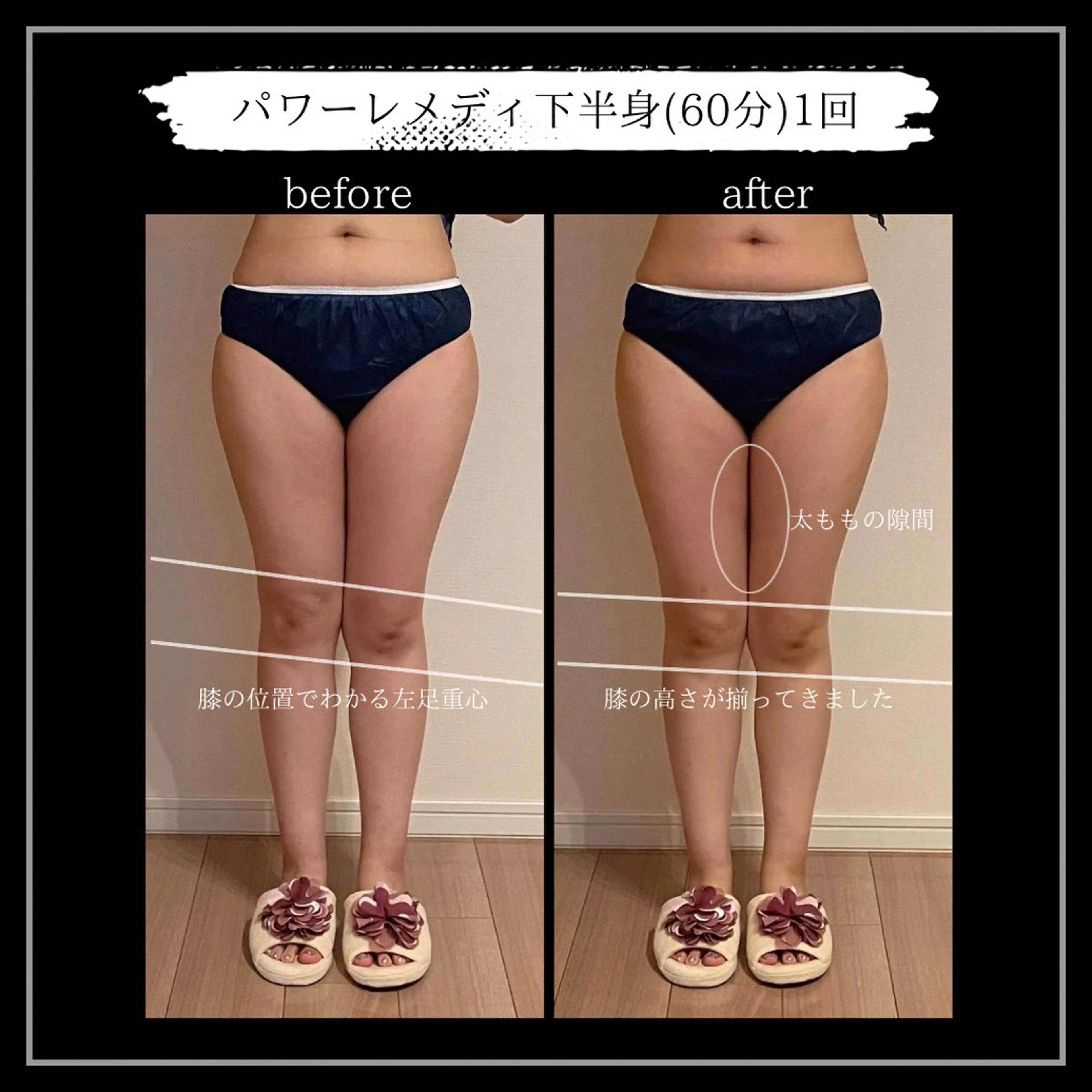 オフ:オン所属・オフ:オン 全身筋膜マッサージのエステ・リラクイメージ