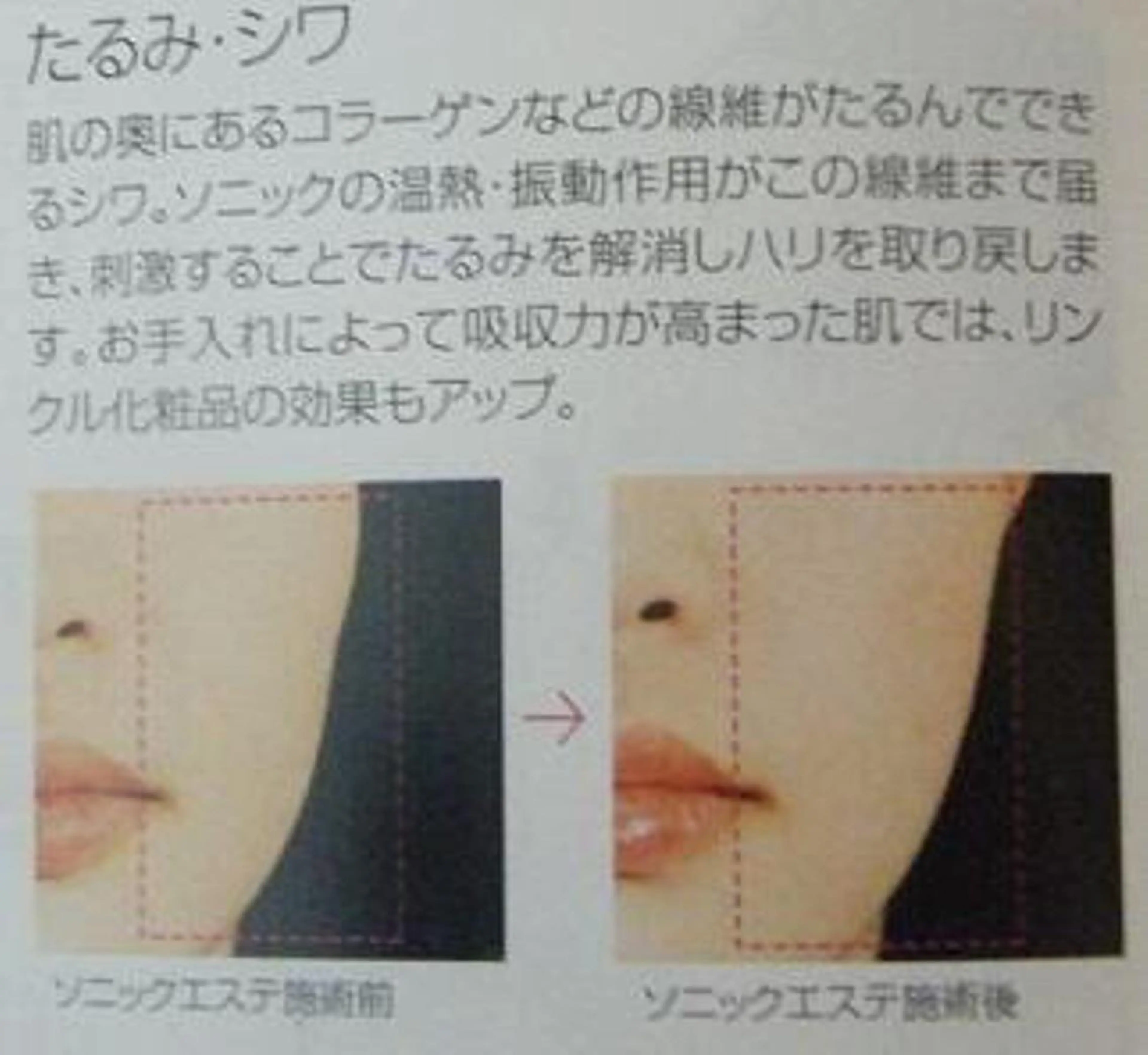 skinLabo所属・saya Mのエステ・リラクイメージ