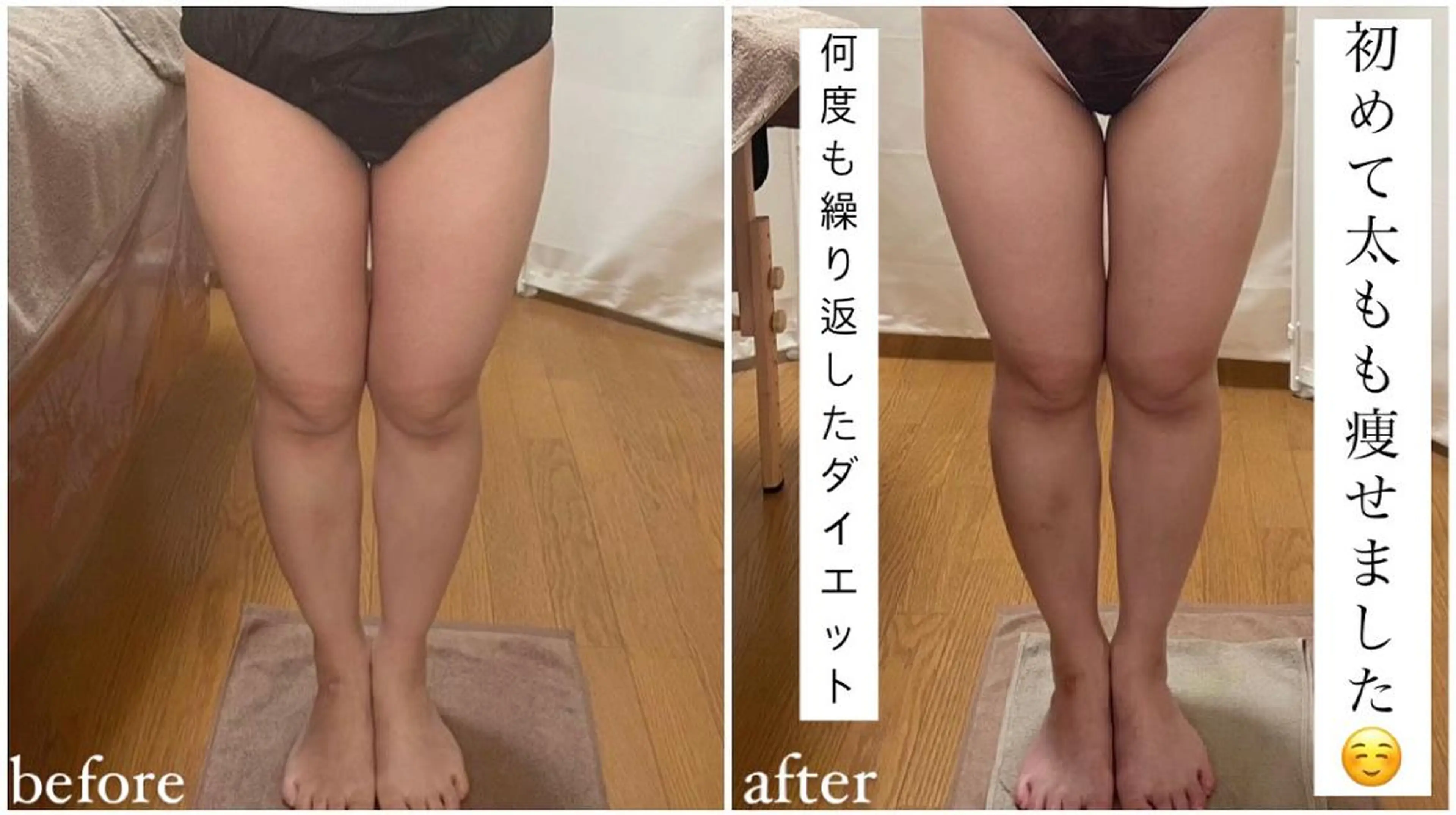 biloop所属・《痩身×疲労改善》 BILOOPのエステ・リラクイメージ