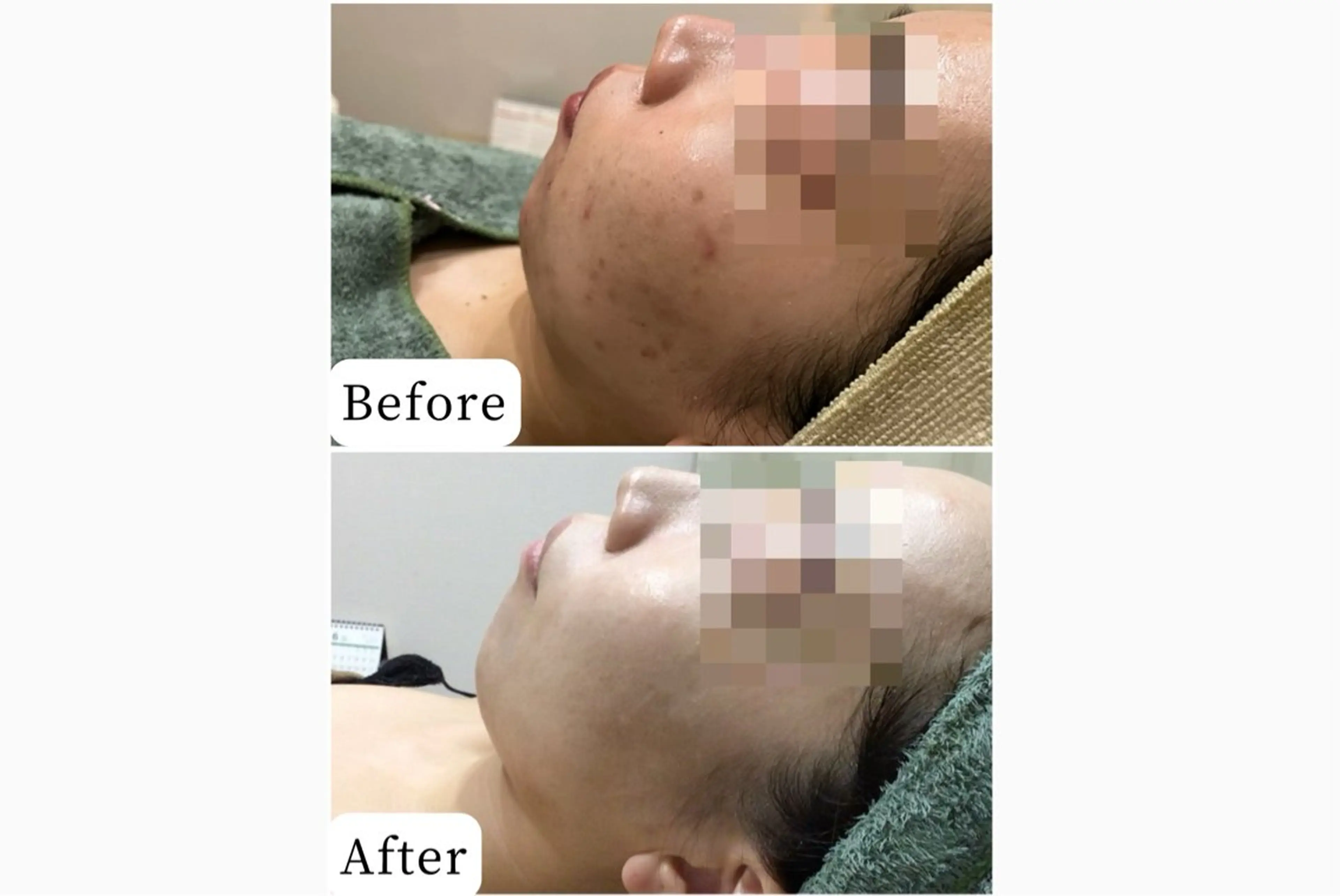 ハーブピーリング専門 muro.のエステ・リラクイメージ