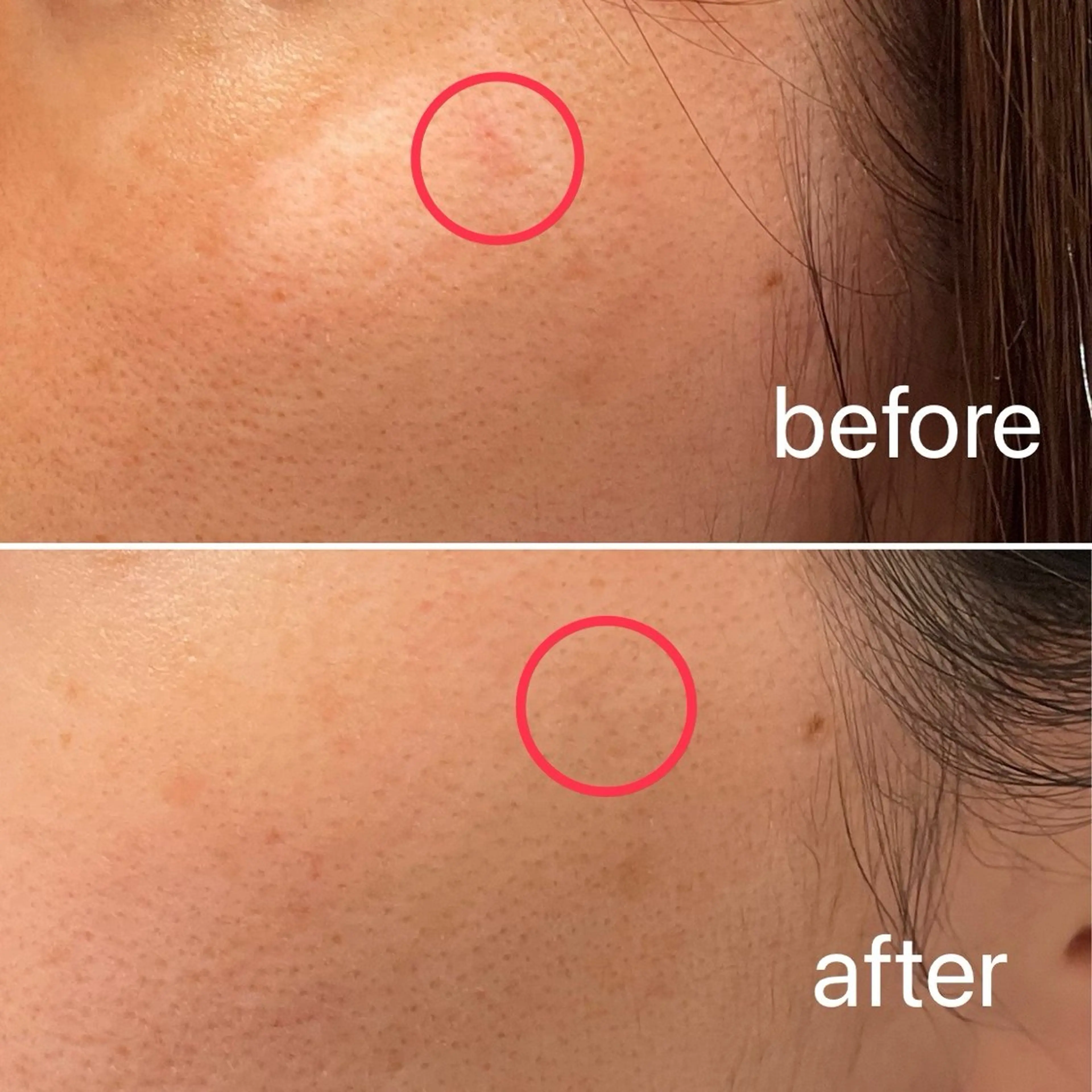 痛くないシミ取り 【荻窪】石橋のヘアスタイル