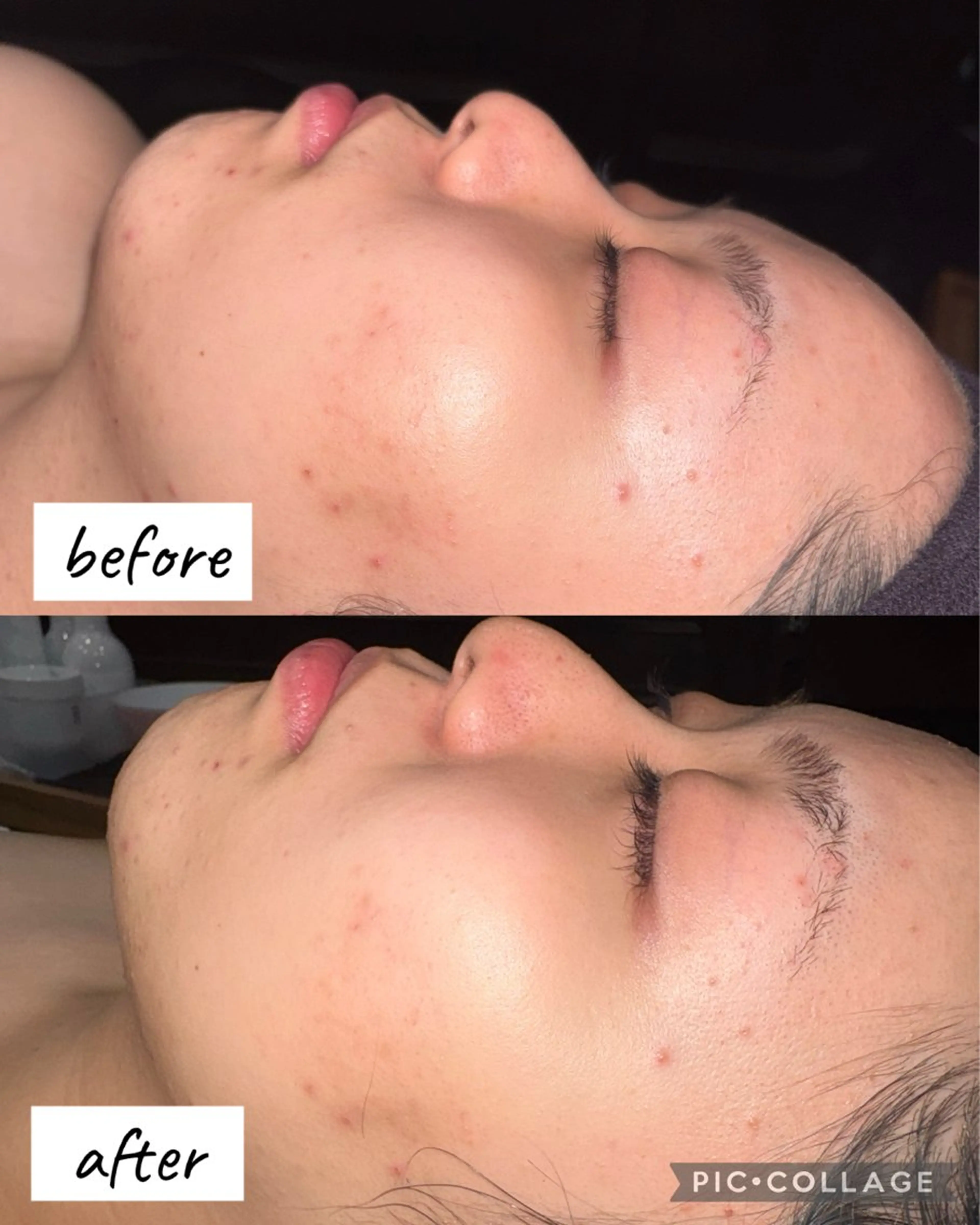 レディースシェービング(パック付き)の写真