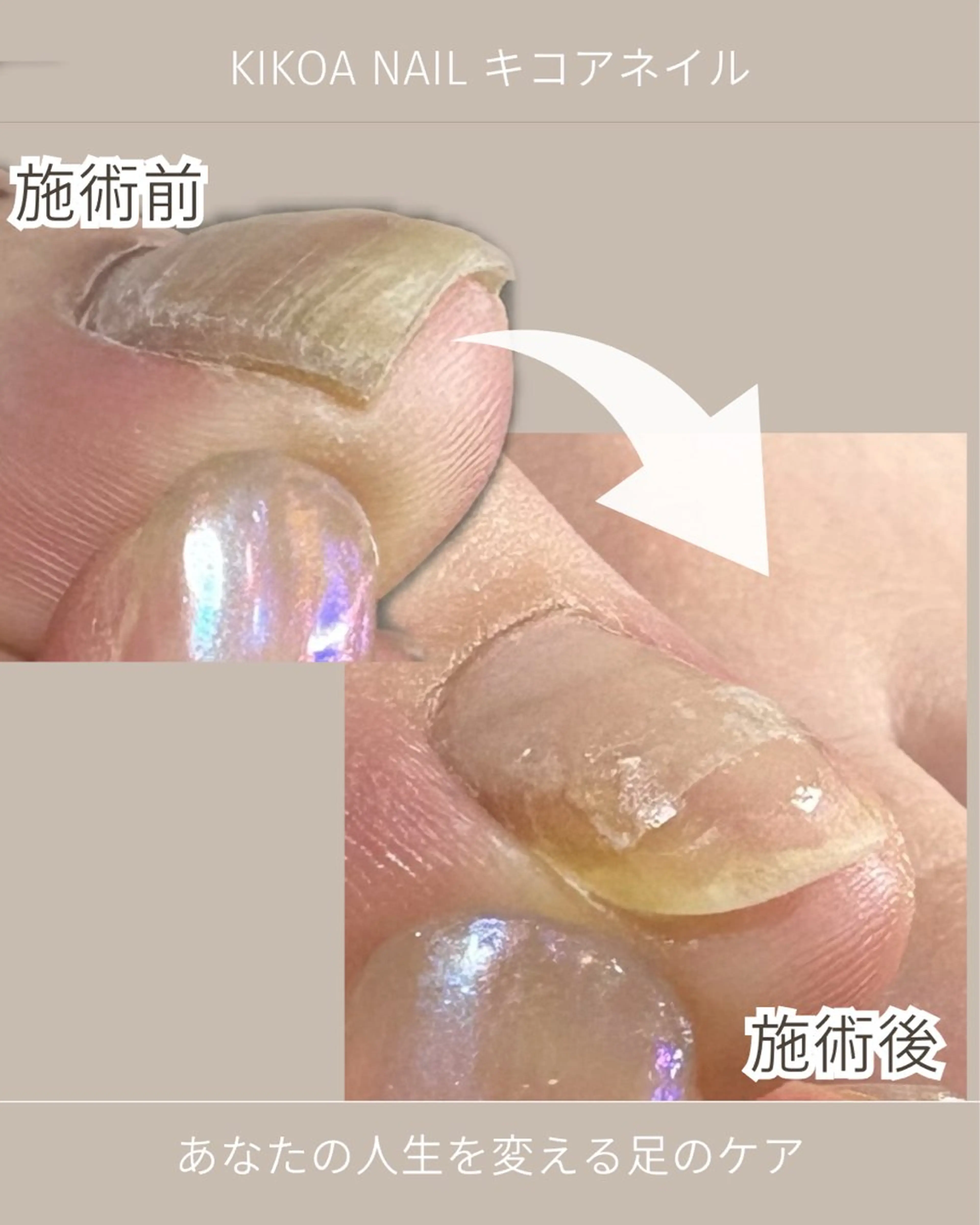 ネイル フットネイル KIKOA NAIL キコアネイルのネイルデザイン