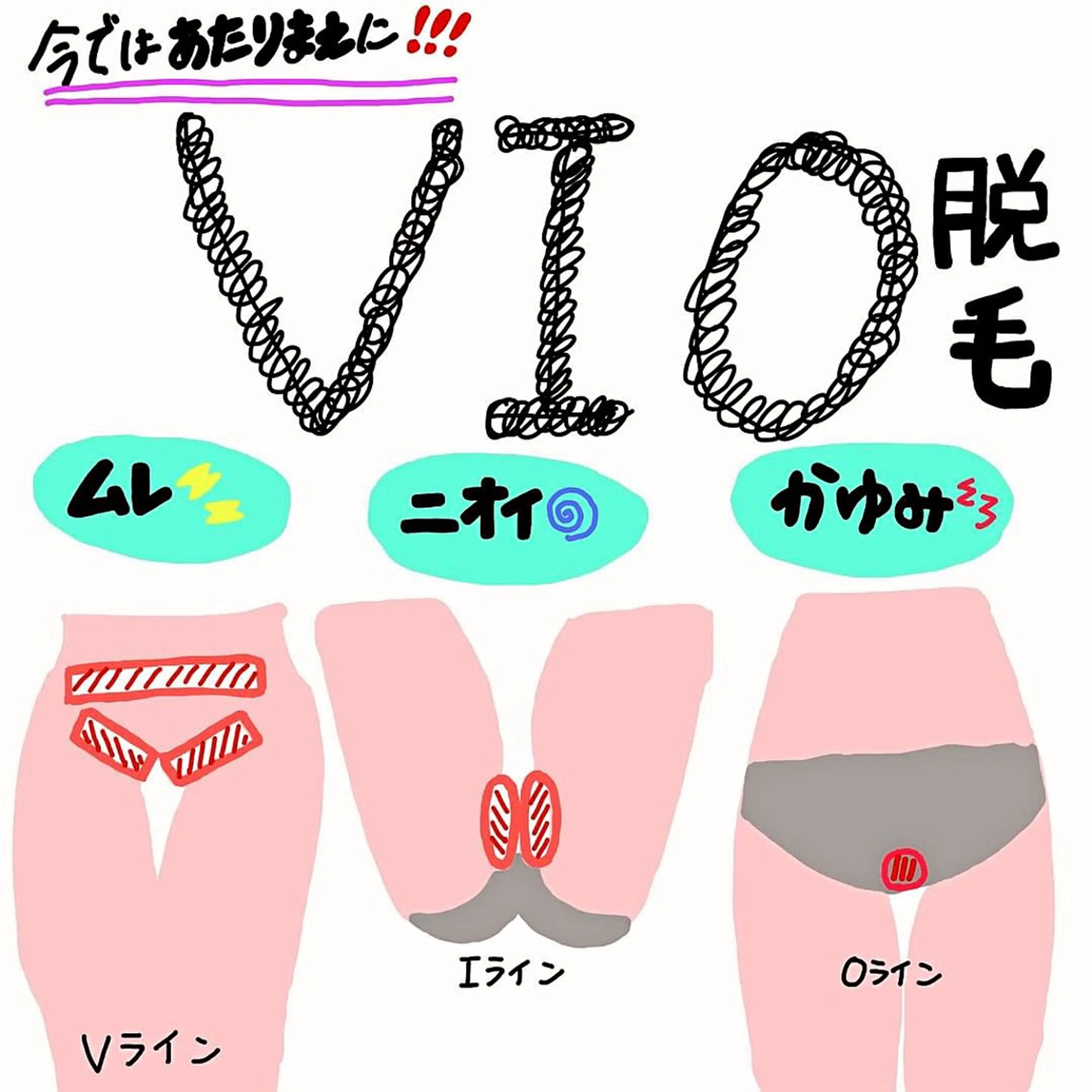 《大人気女性VIO脱毛》元介護士が行うから安心★痛み軽減◎初回お試しの写真