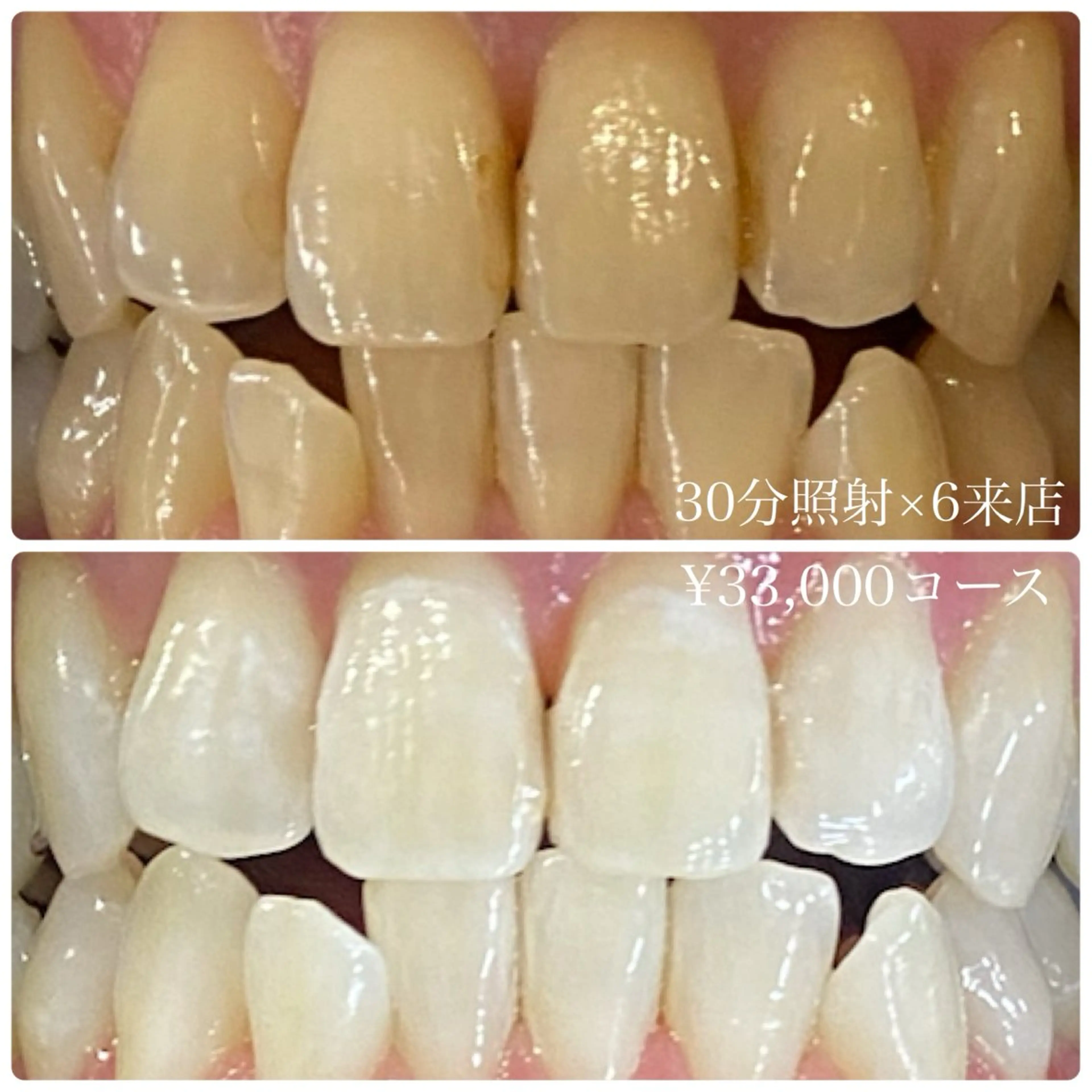 メンズ その他 ホワイトニングルーム　川崎店所属・ホワイトニング ルーム　川崎店のその他イメージ