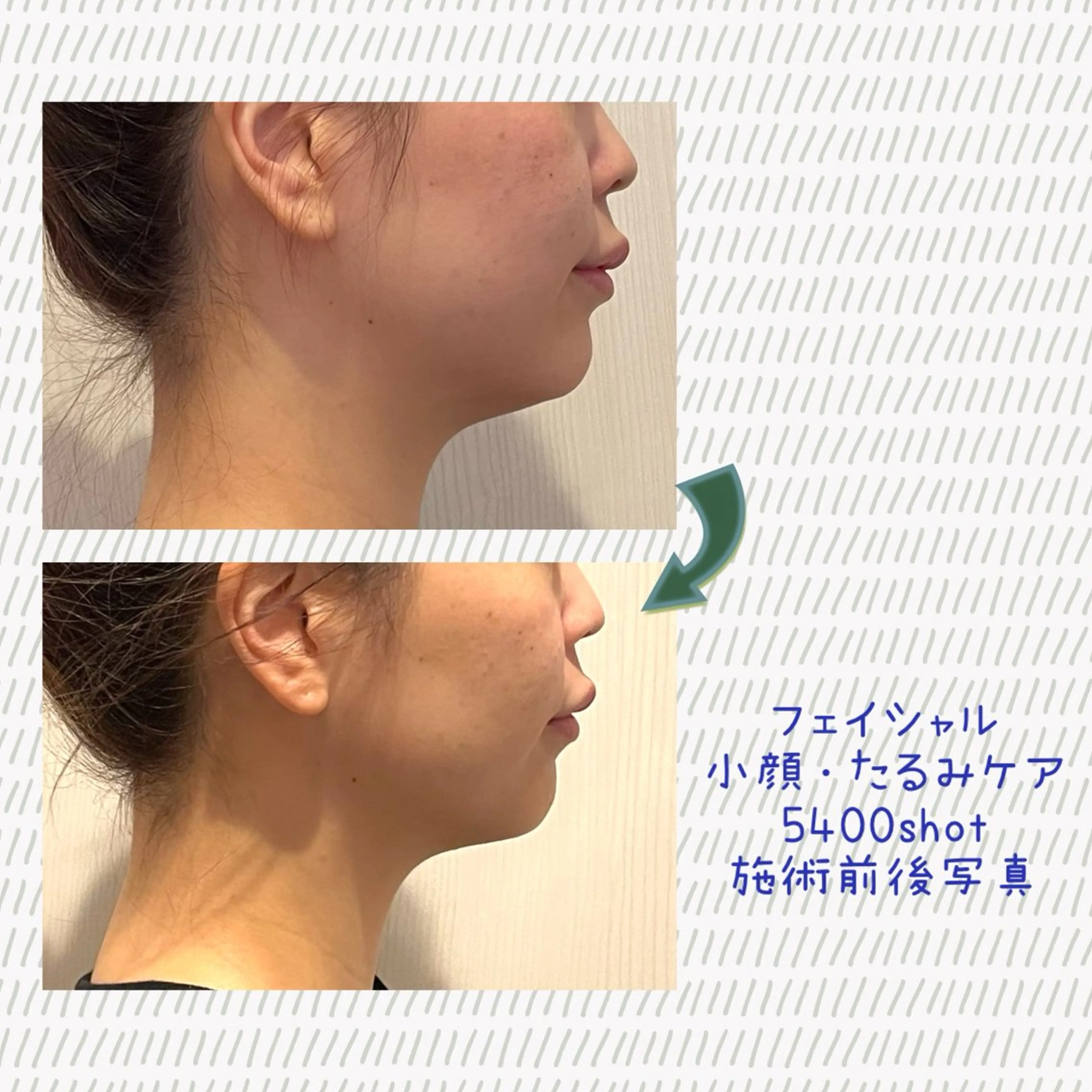 Laplace池袋本店(ラプラス池袋本店)所属・Laplace 池袋本店のその他イメージ